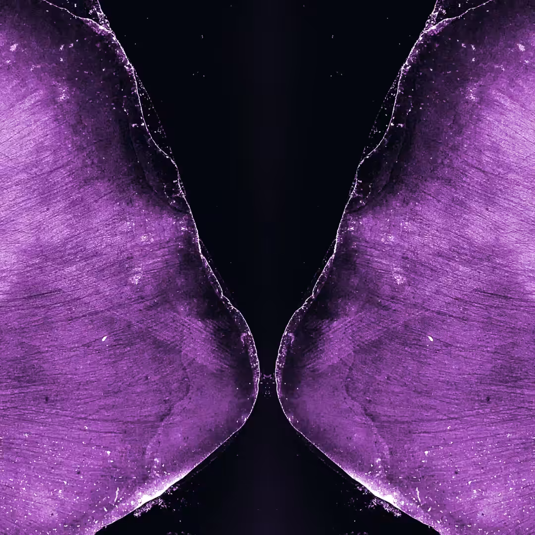 Mitosis