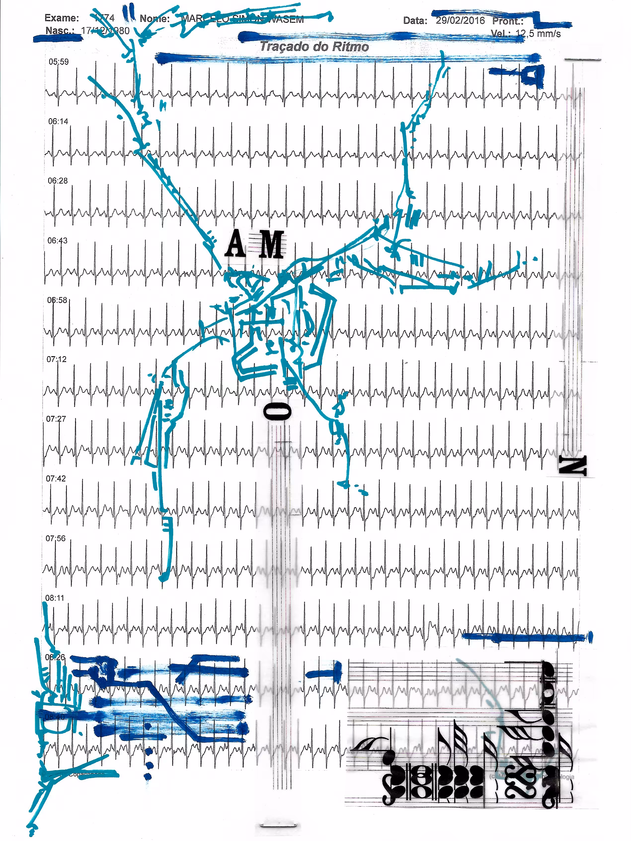 Tracing Rhythms II (AM.O.N)