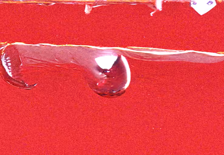 metallic blood