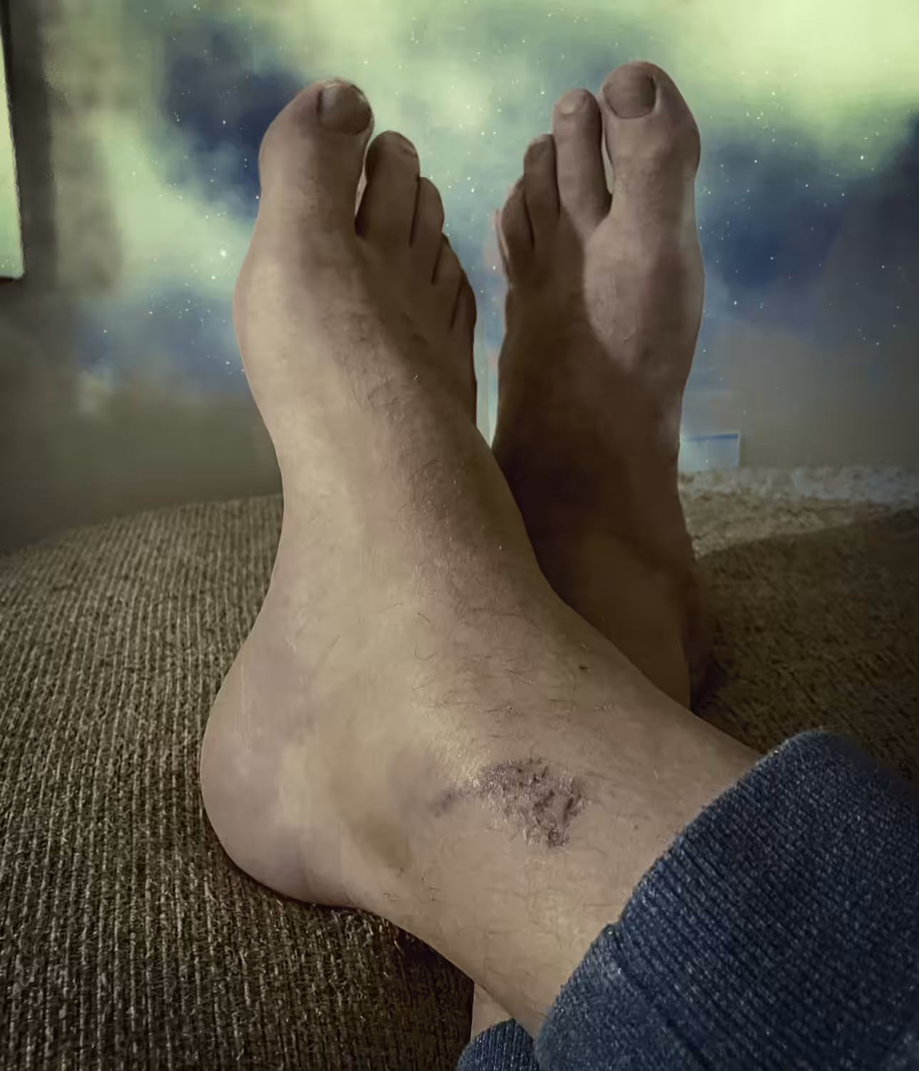 stud:1 Ankle 0