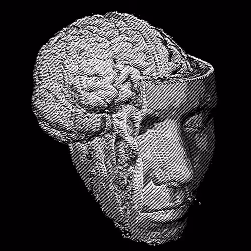 Engraved Brainscan