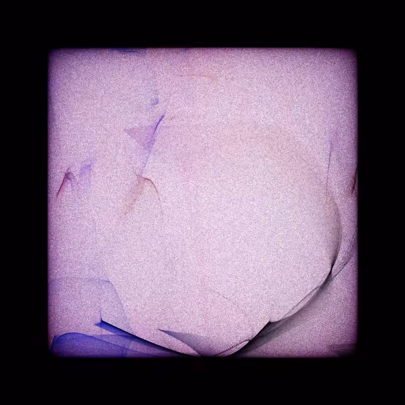 Bifurcation #53
