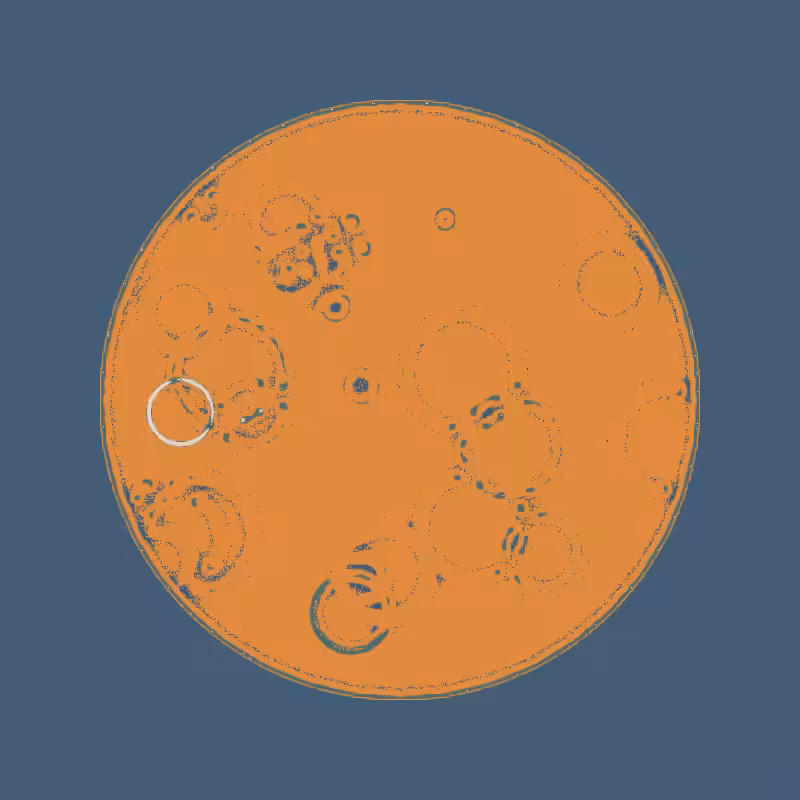 Cheap Petri Dish #76