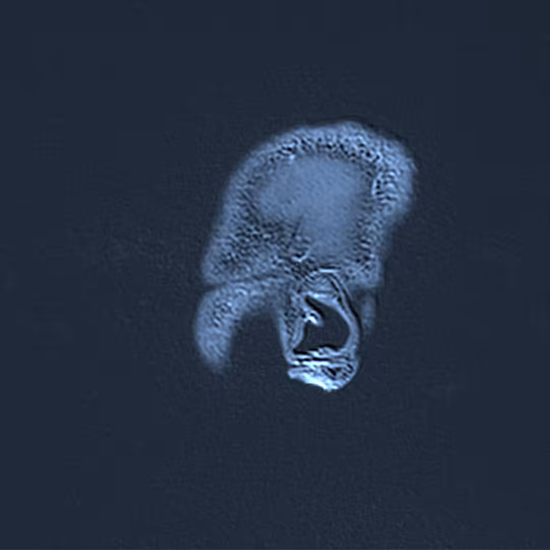 The Brain 01