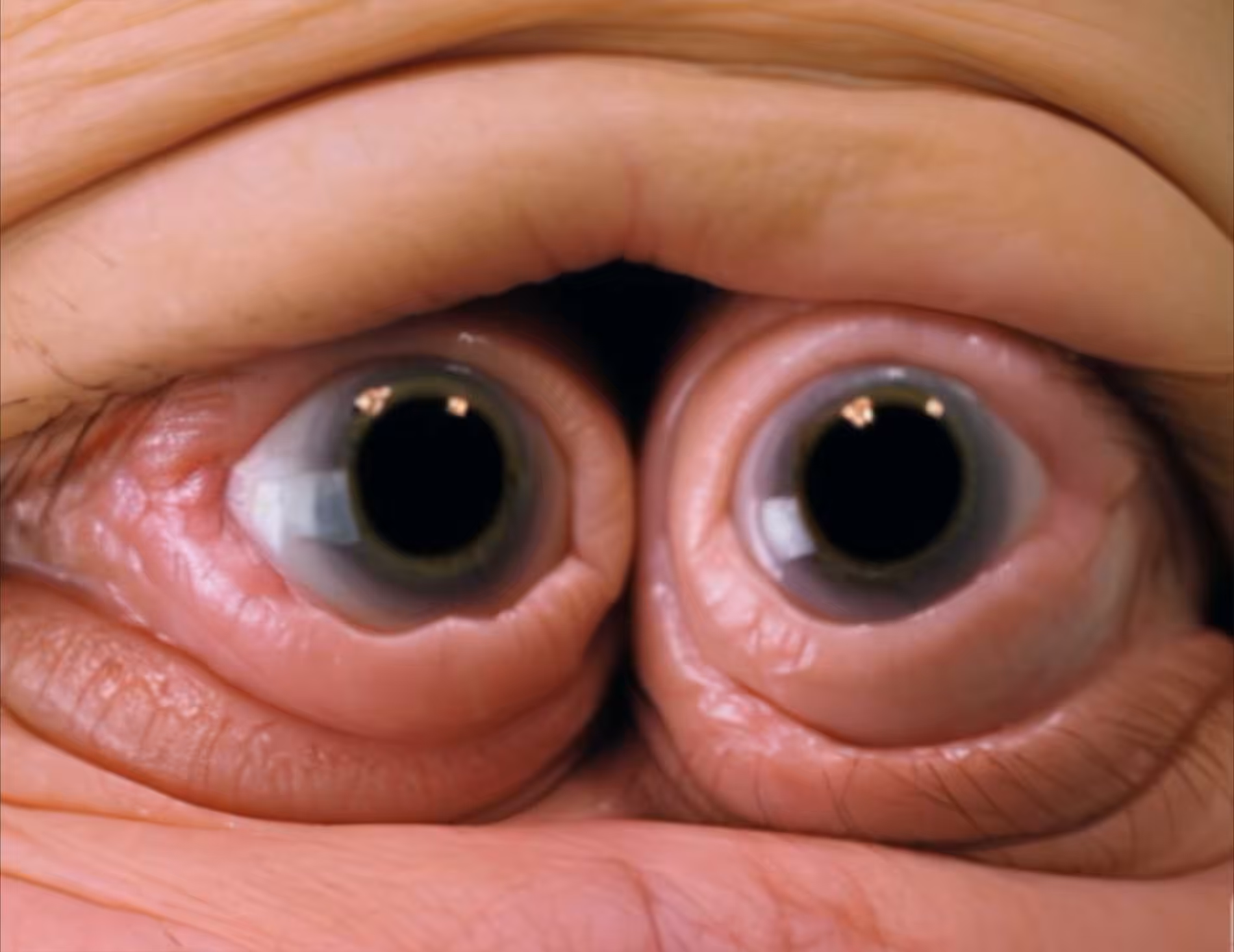 Bengt Tibert - Bob