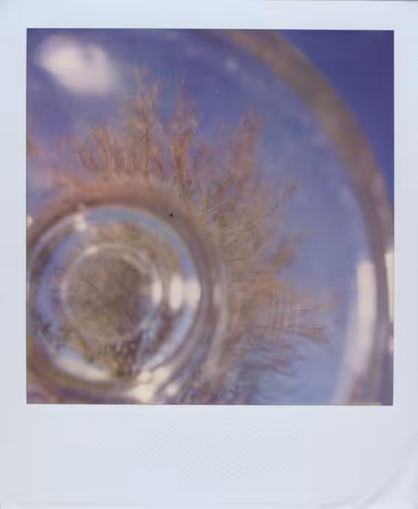 Eye