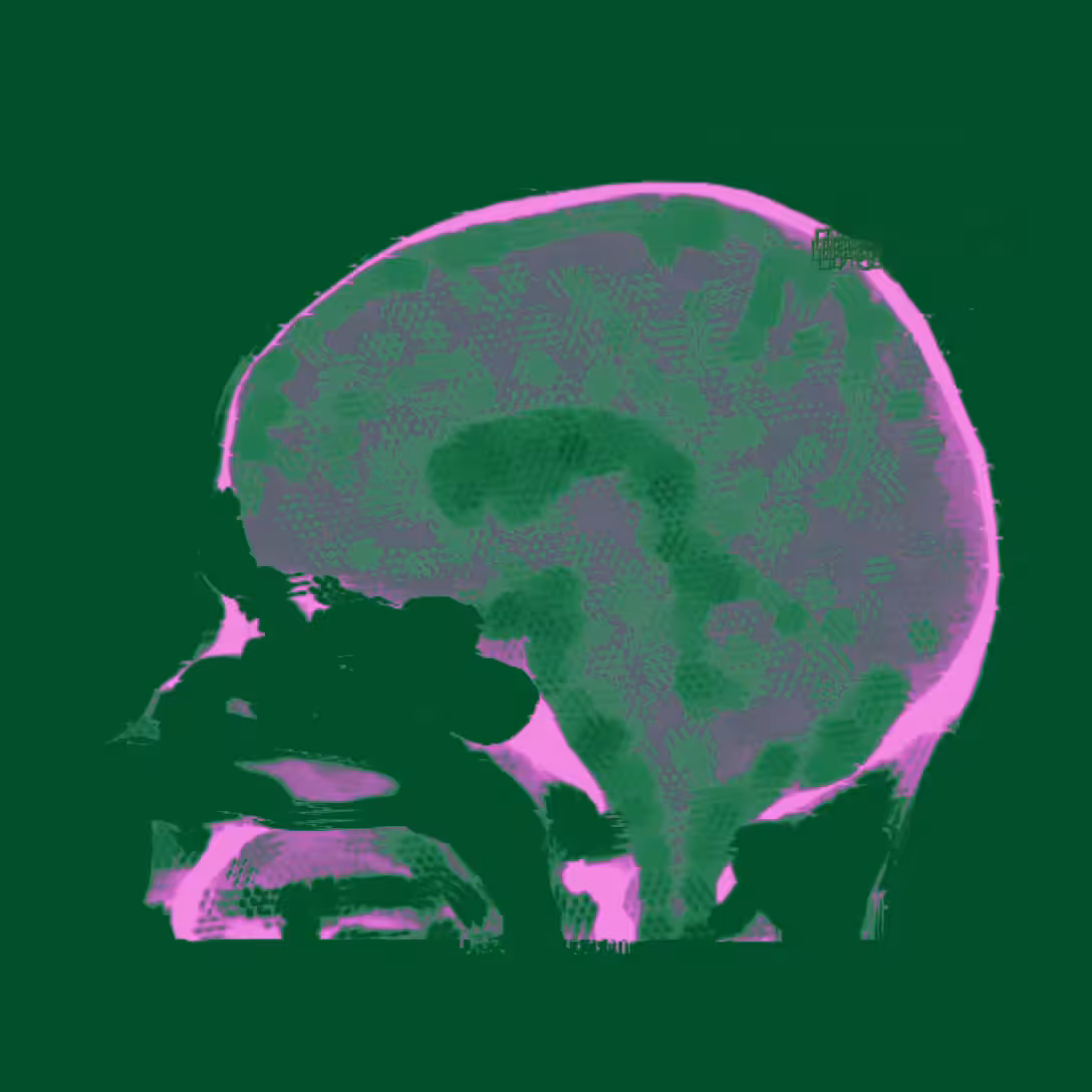 <_MyHead_n3_>