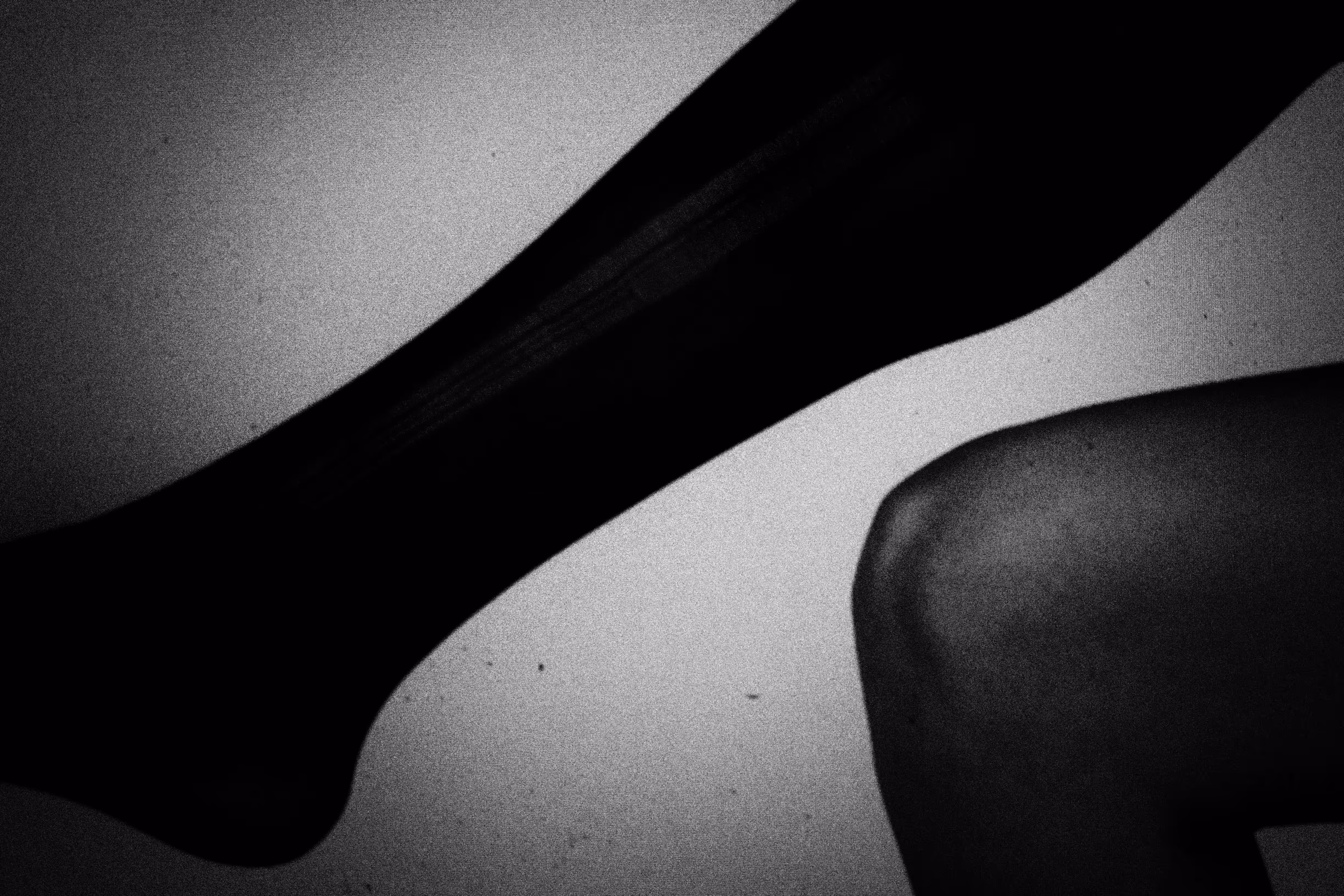 Legs