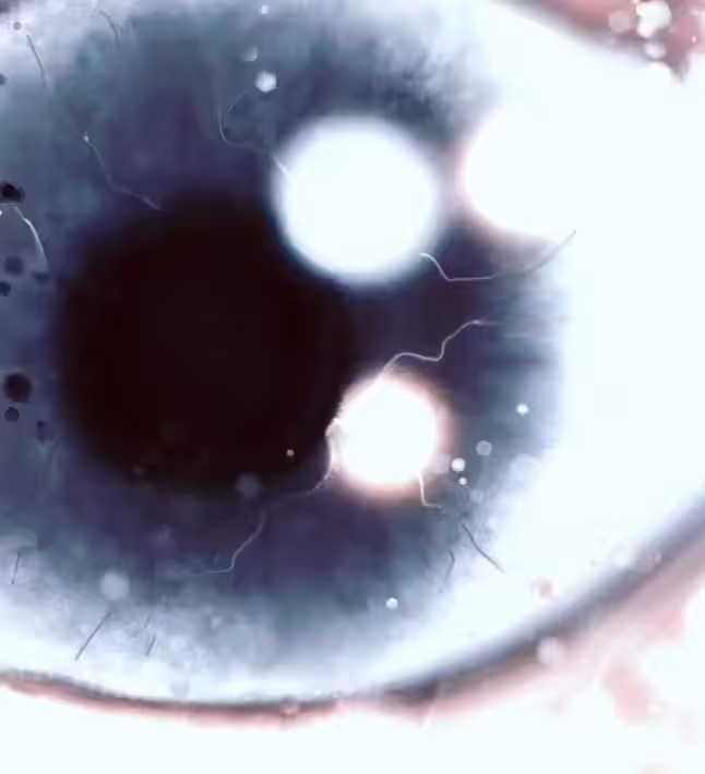 Forever Dilatying Eye (VIDEO)