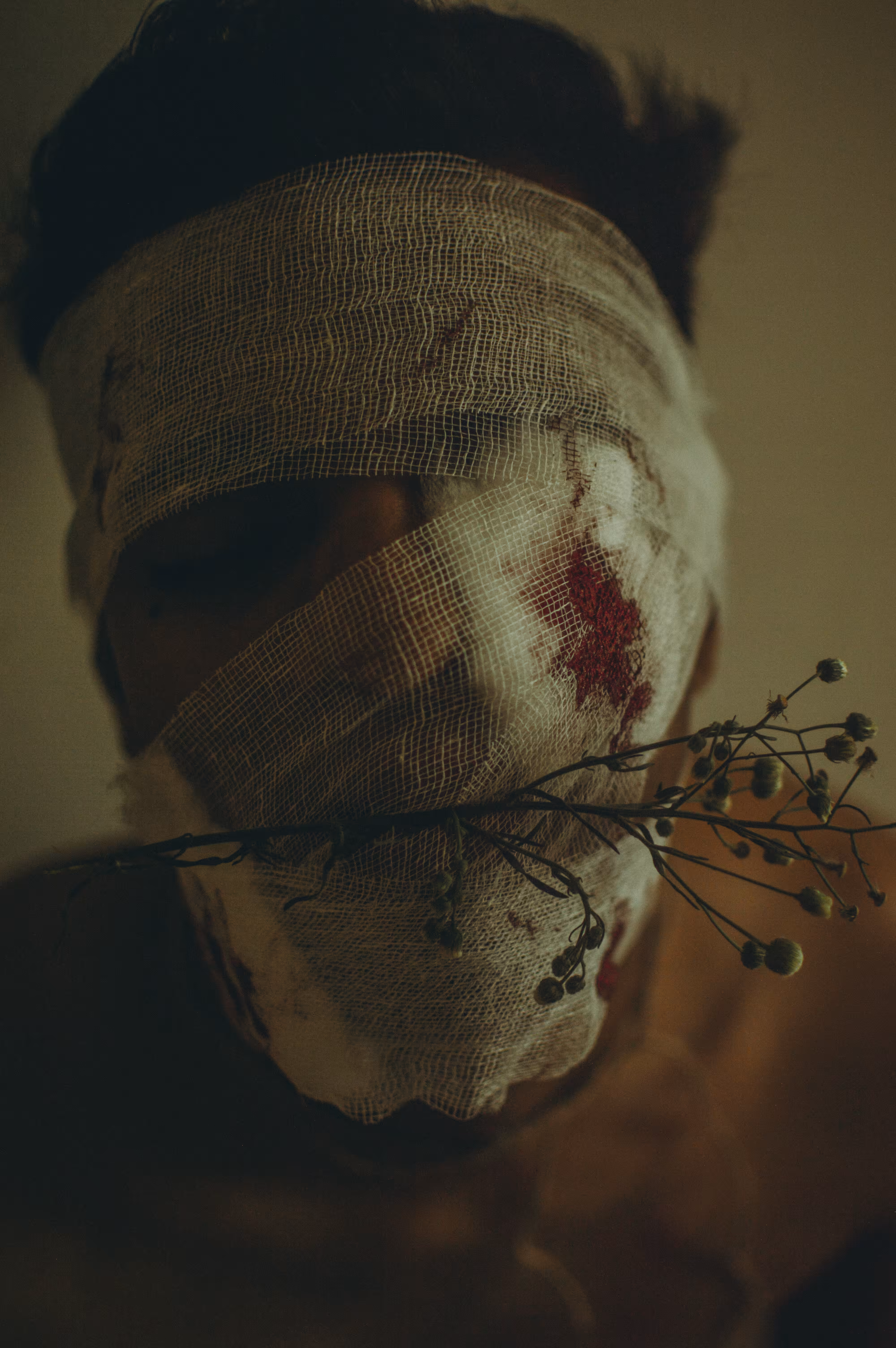 Bruised 