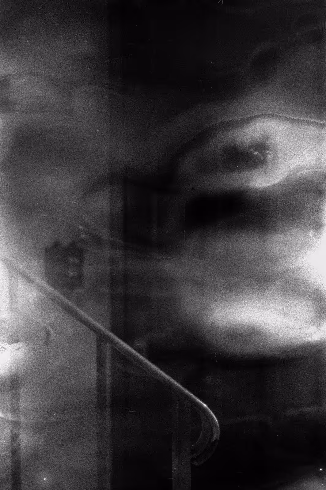 Fog/novocaine