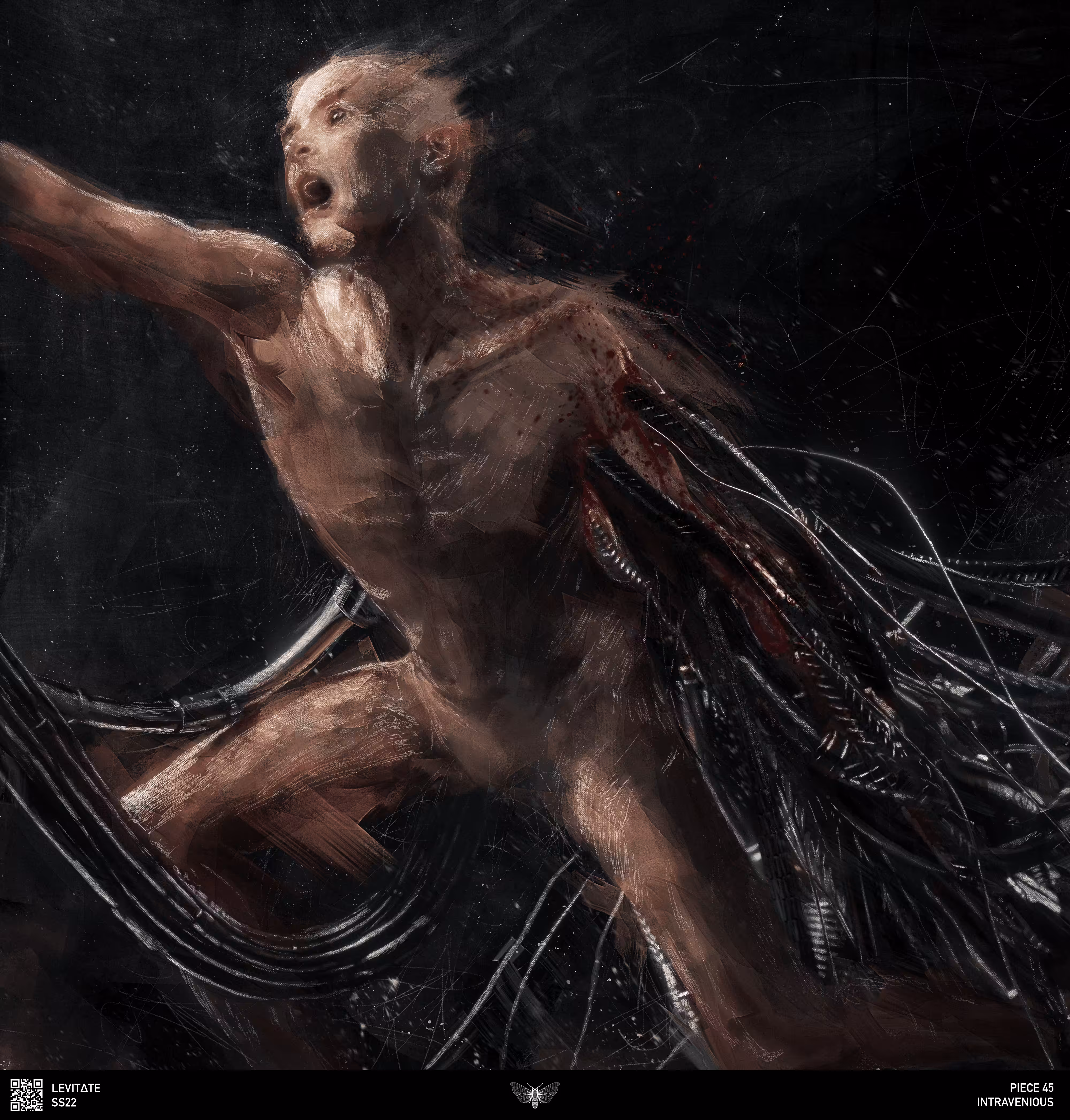 Intravenous