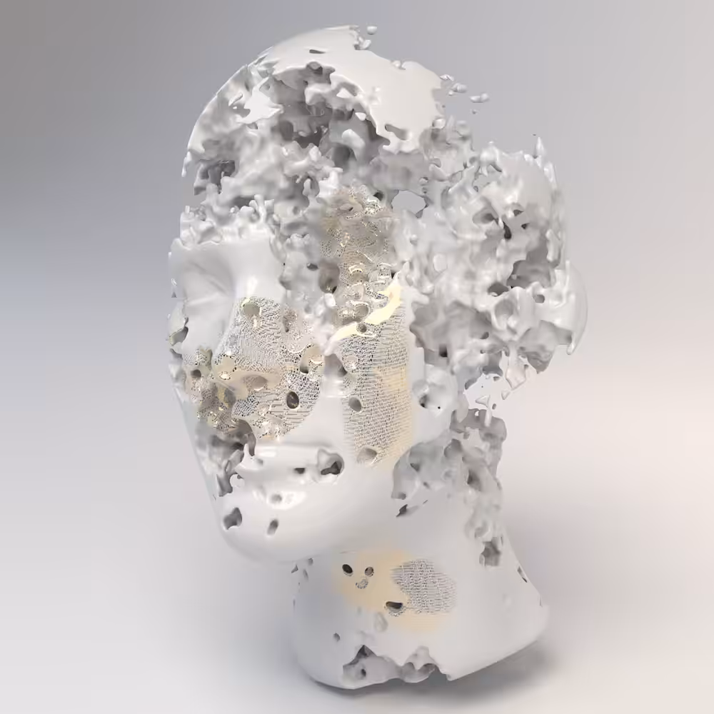 Alzheimer