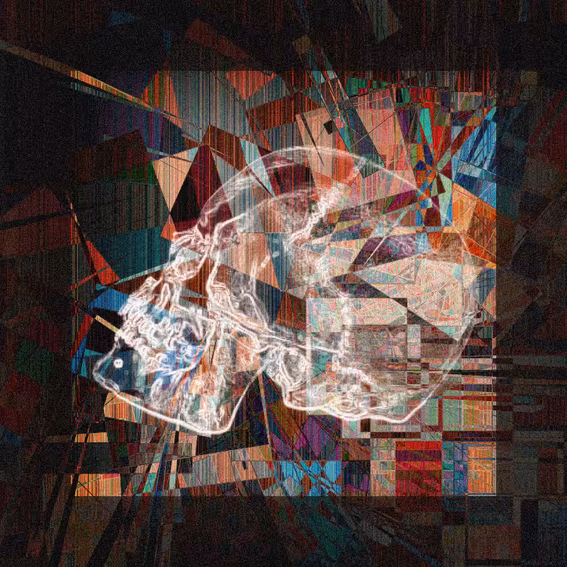 X-ray of a skull #8
