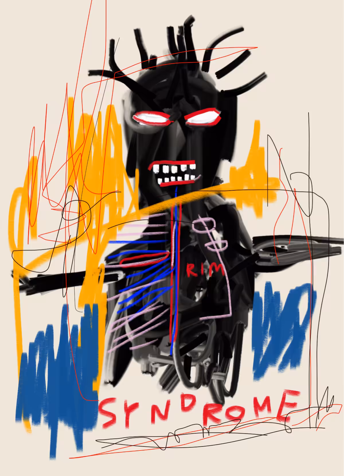 Syndrome