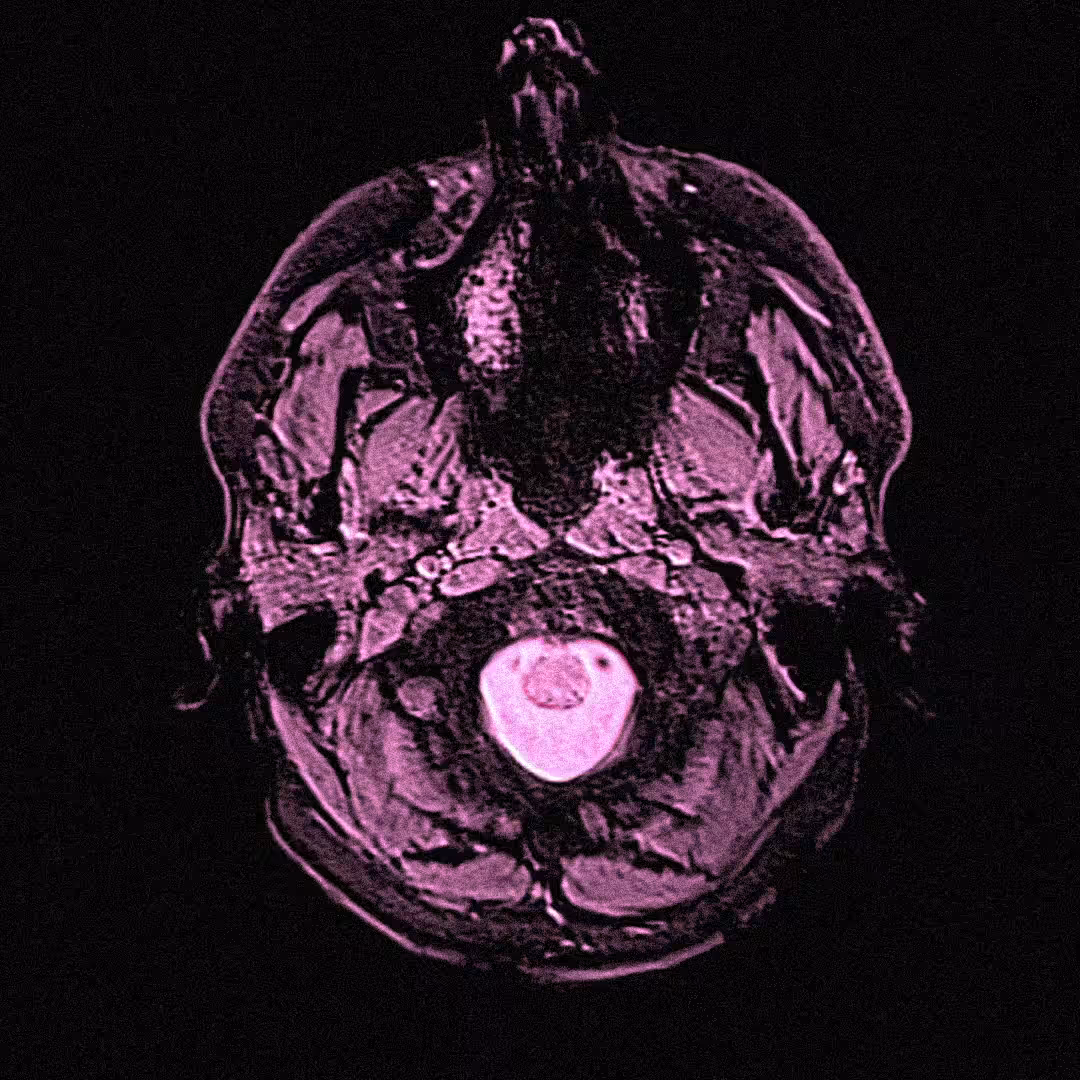 The Brain 03