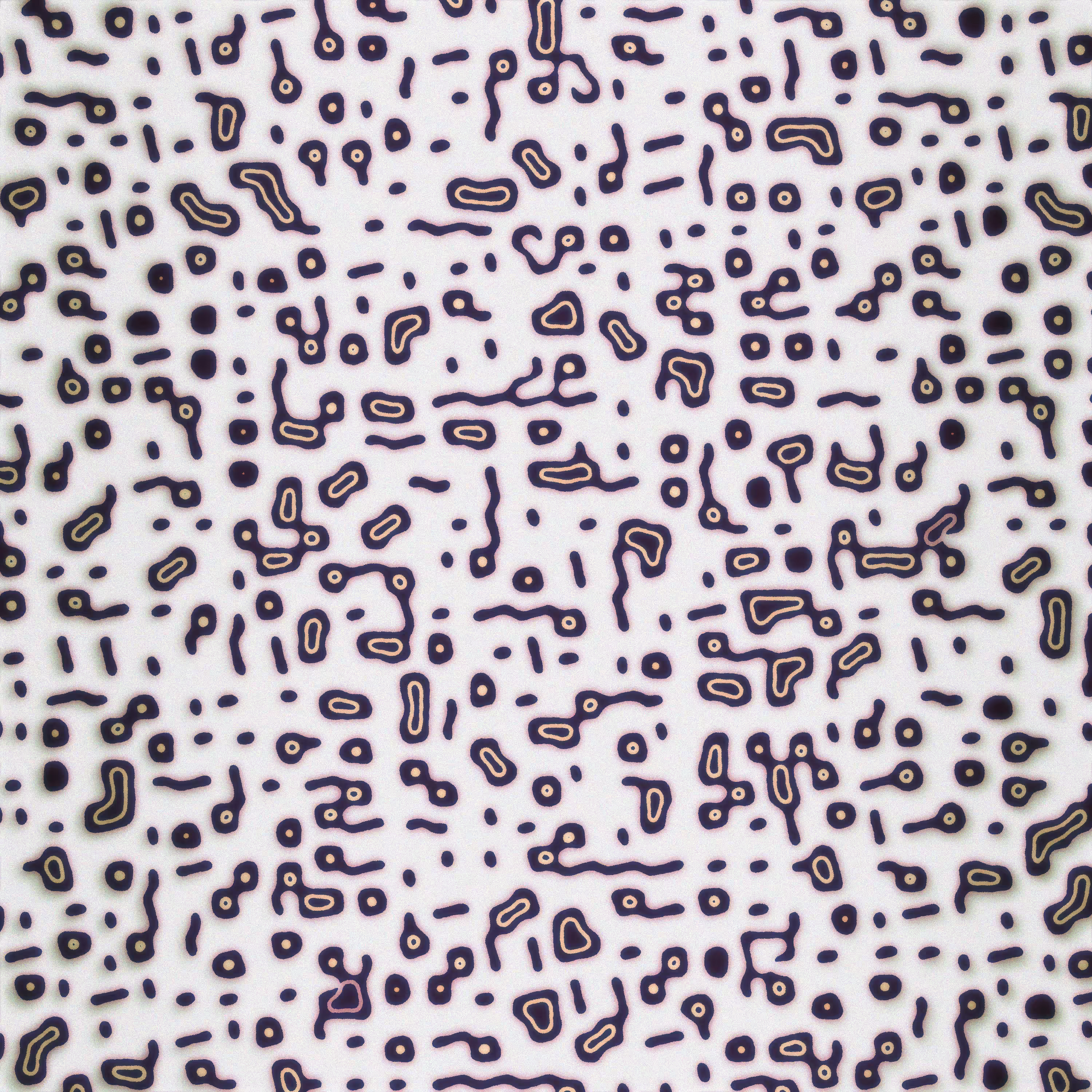 Vermiform