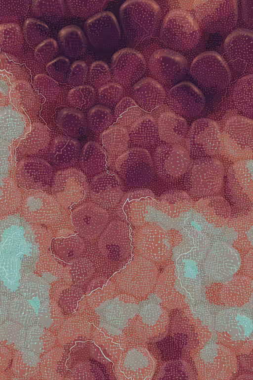 Vitreous #14