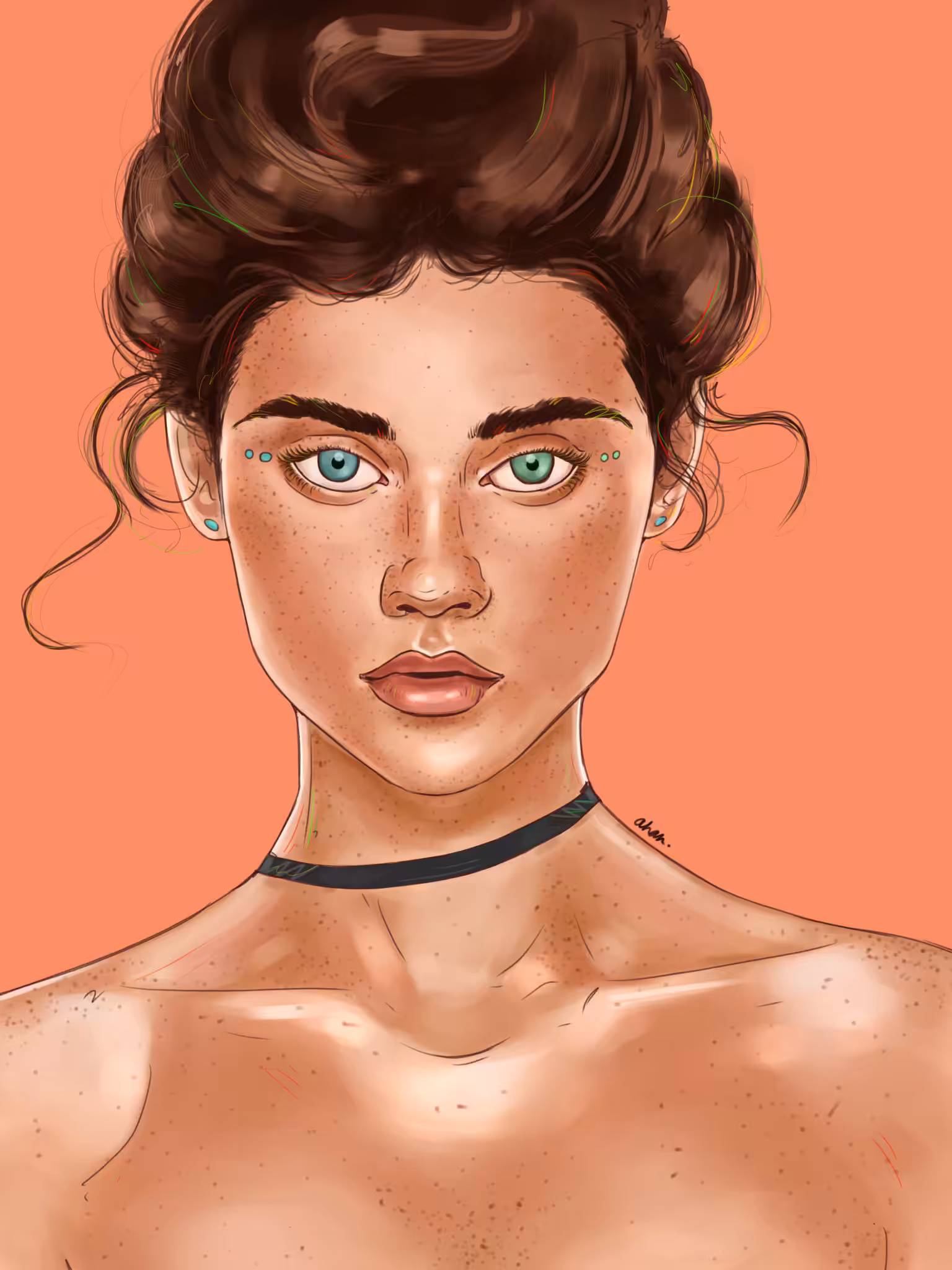 Heterochromia.