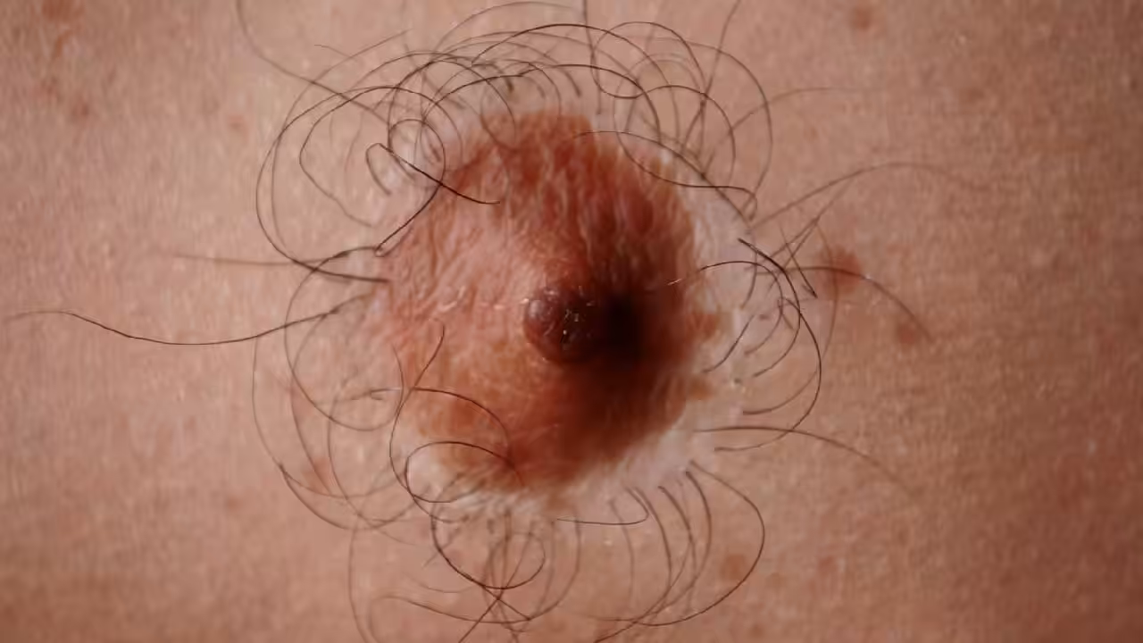 Cringy nipple