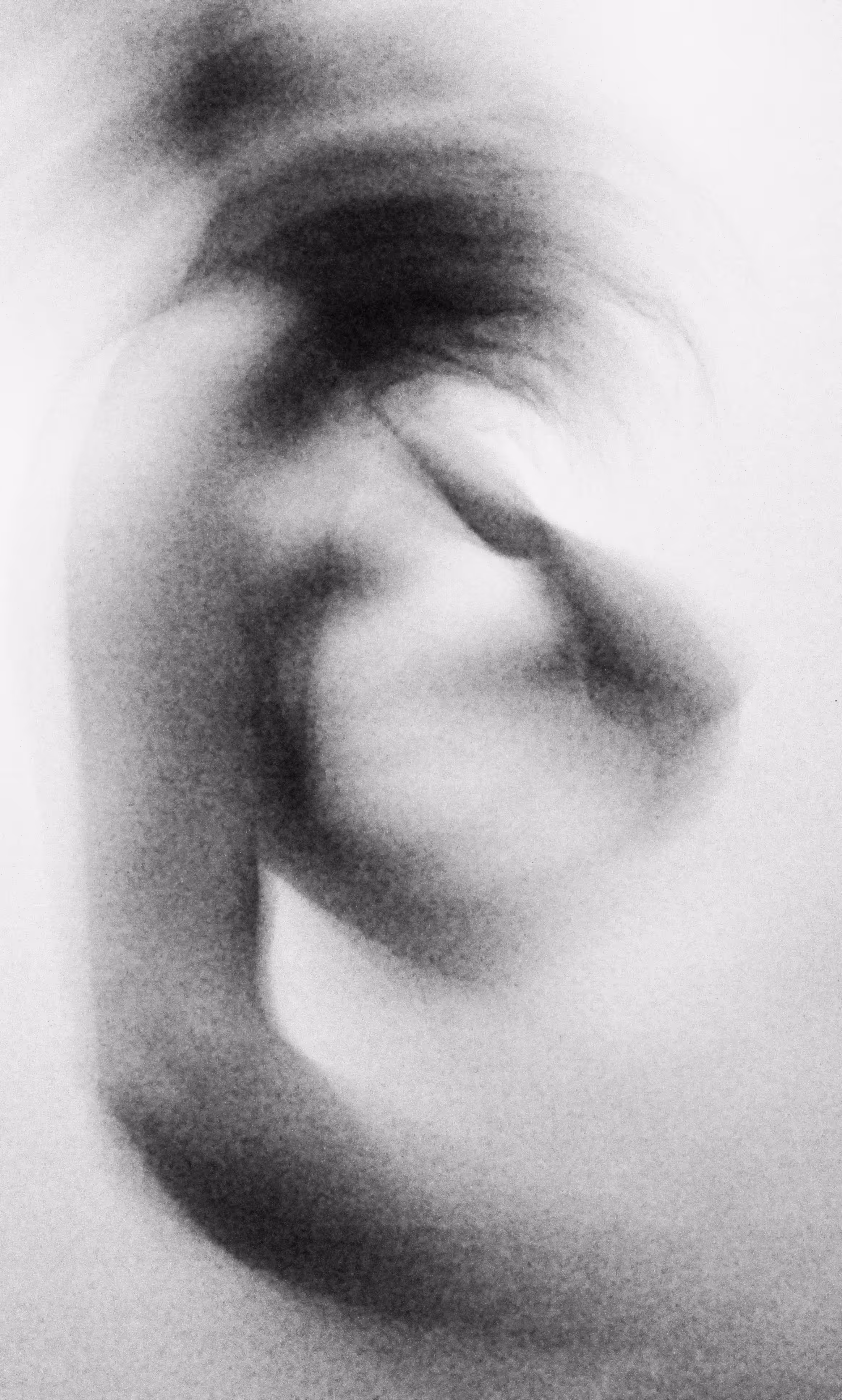 Figure #2 