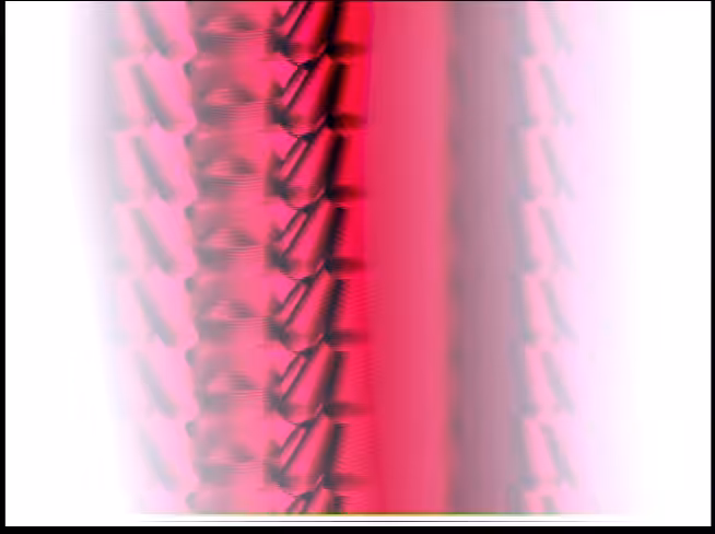 Patch Study Music Video #2
