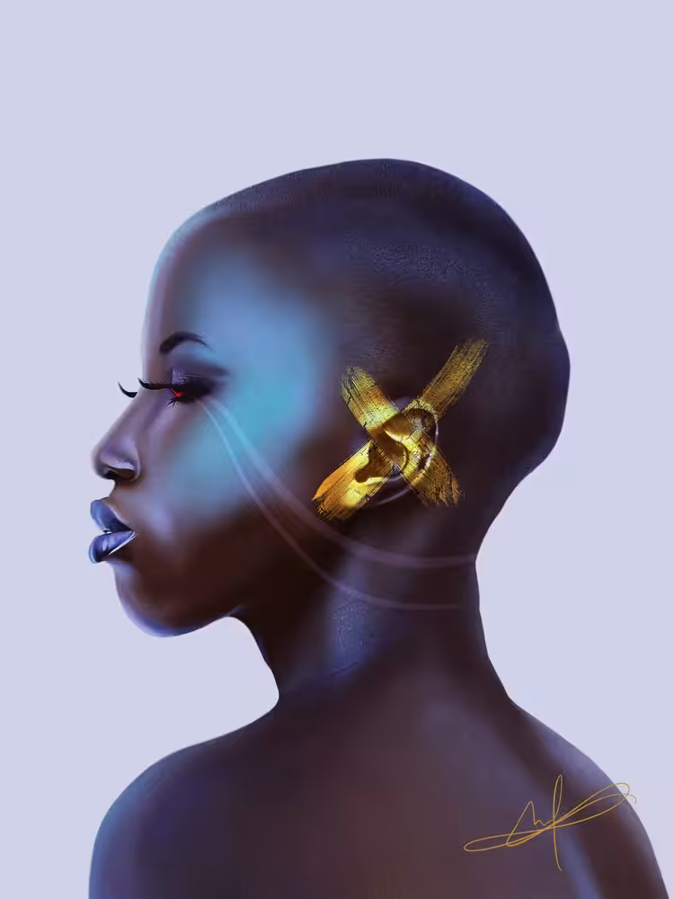 X