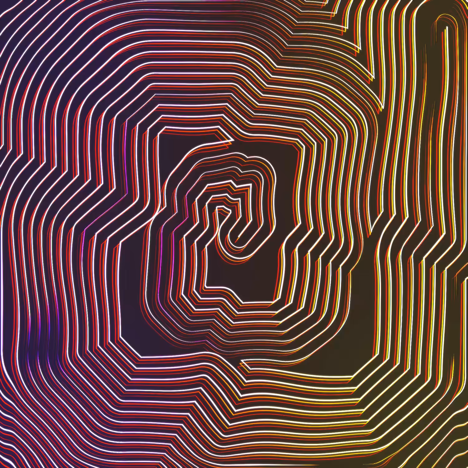 vertigo