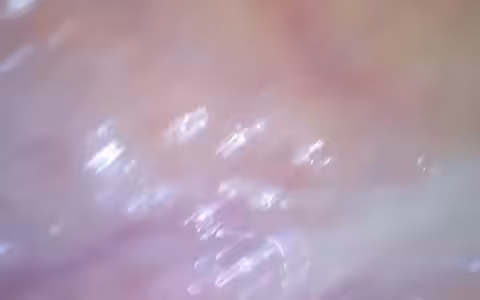carne_1