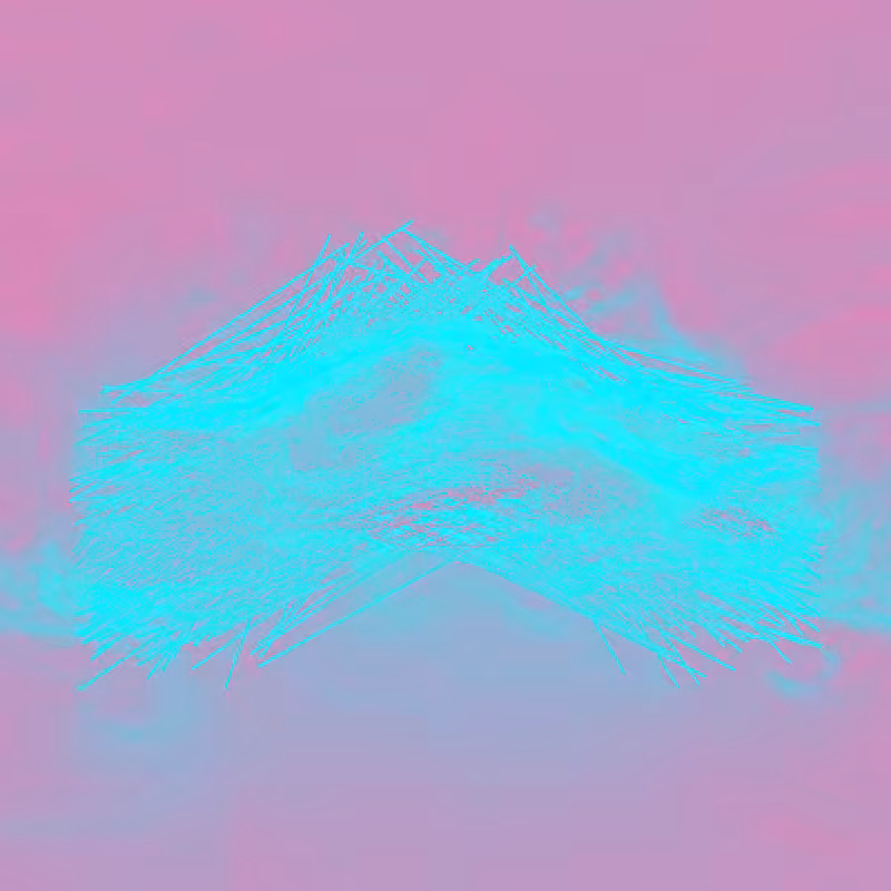 xxf #41
