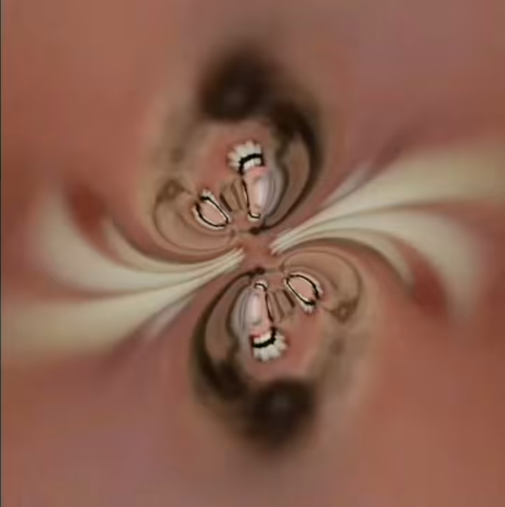 Unusual Cavities