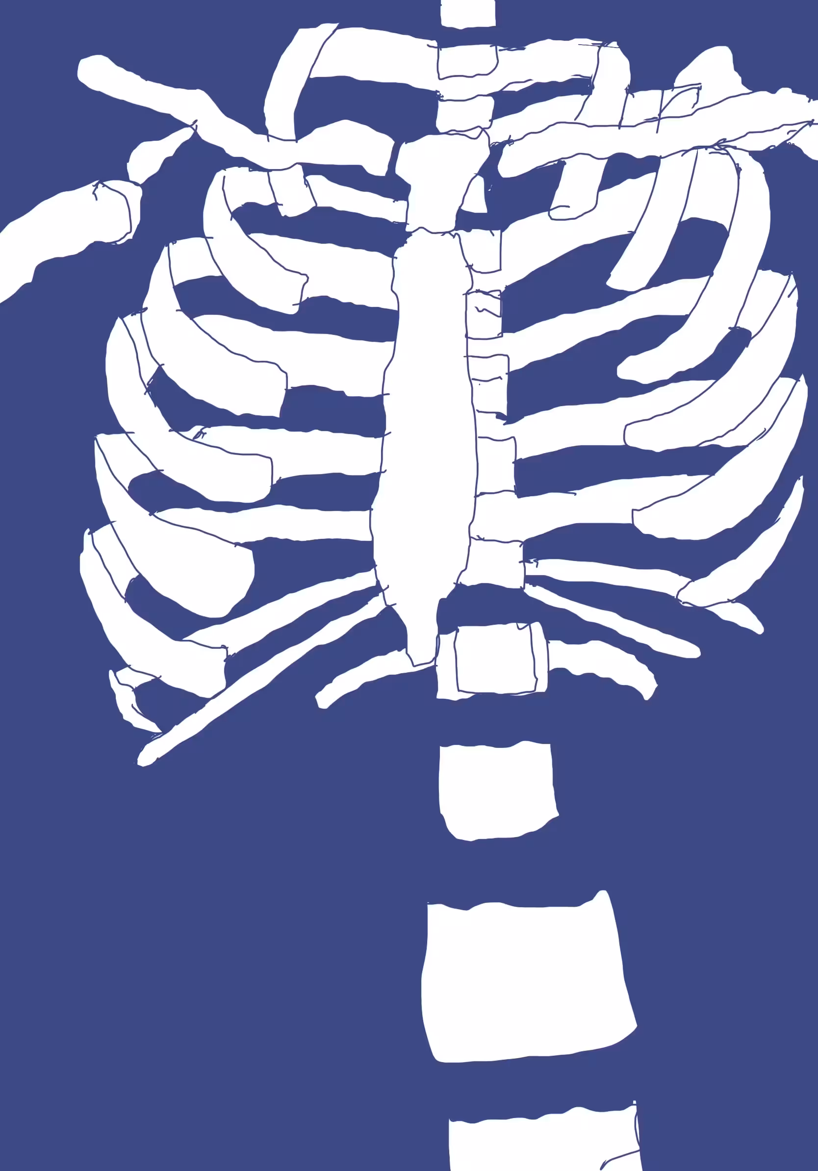 GM! #34 - skeleton chest