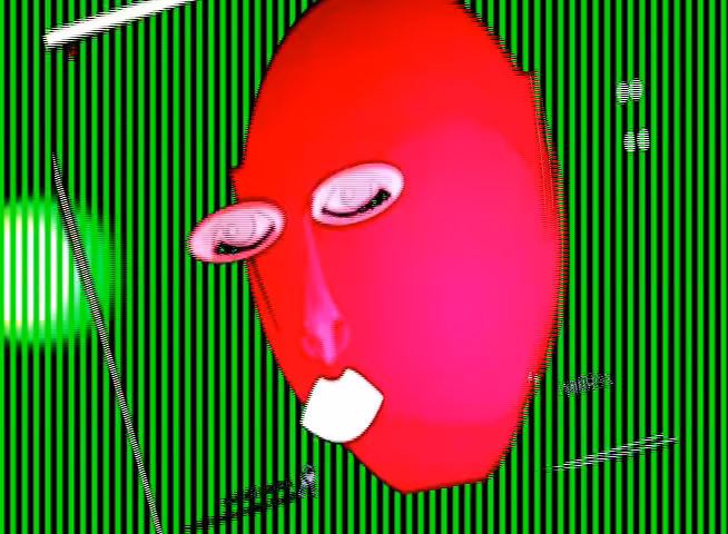 xray