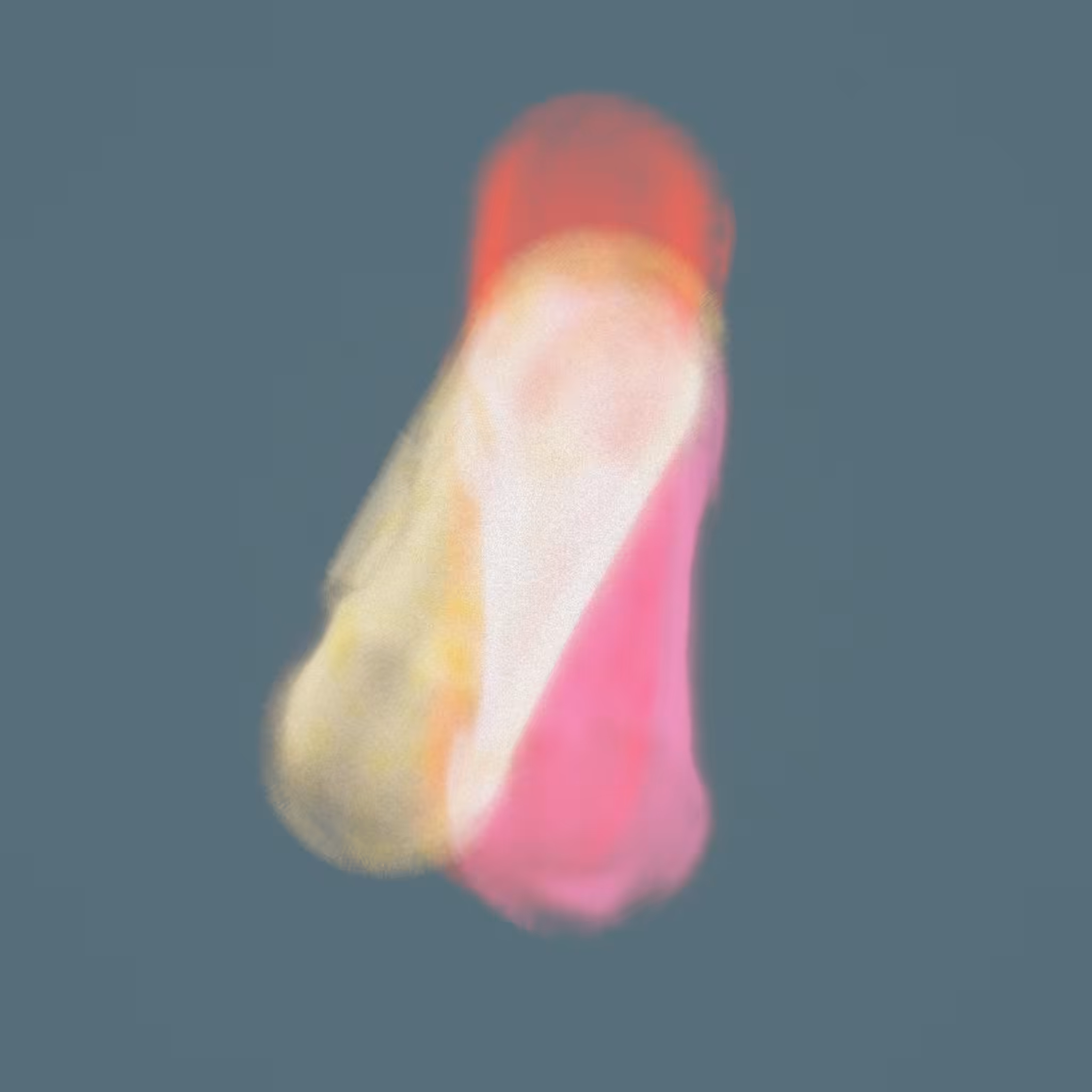 Röntgen's Vice #5