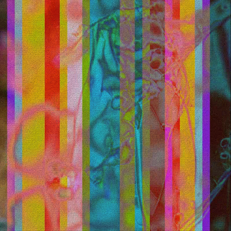 CLDCSMC #152