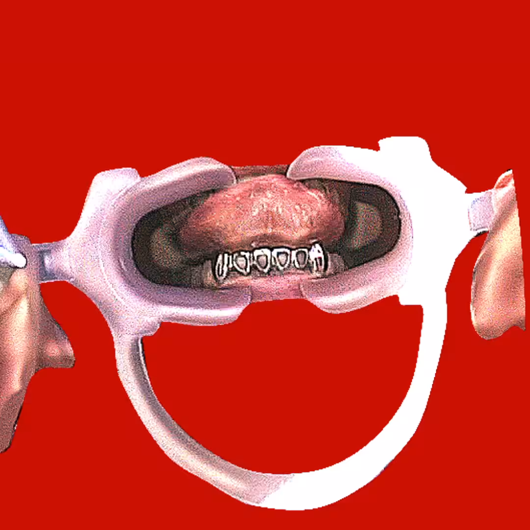 Hello X Grillz