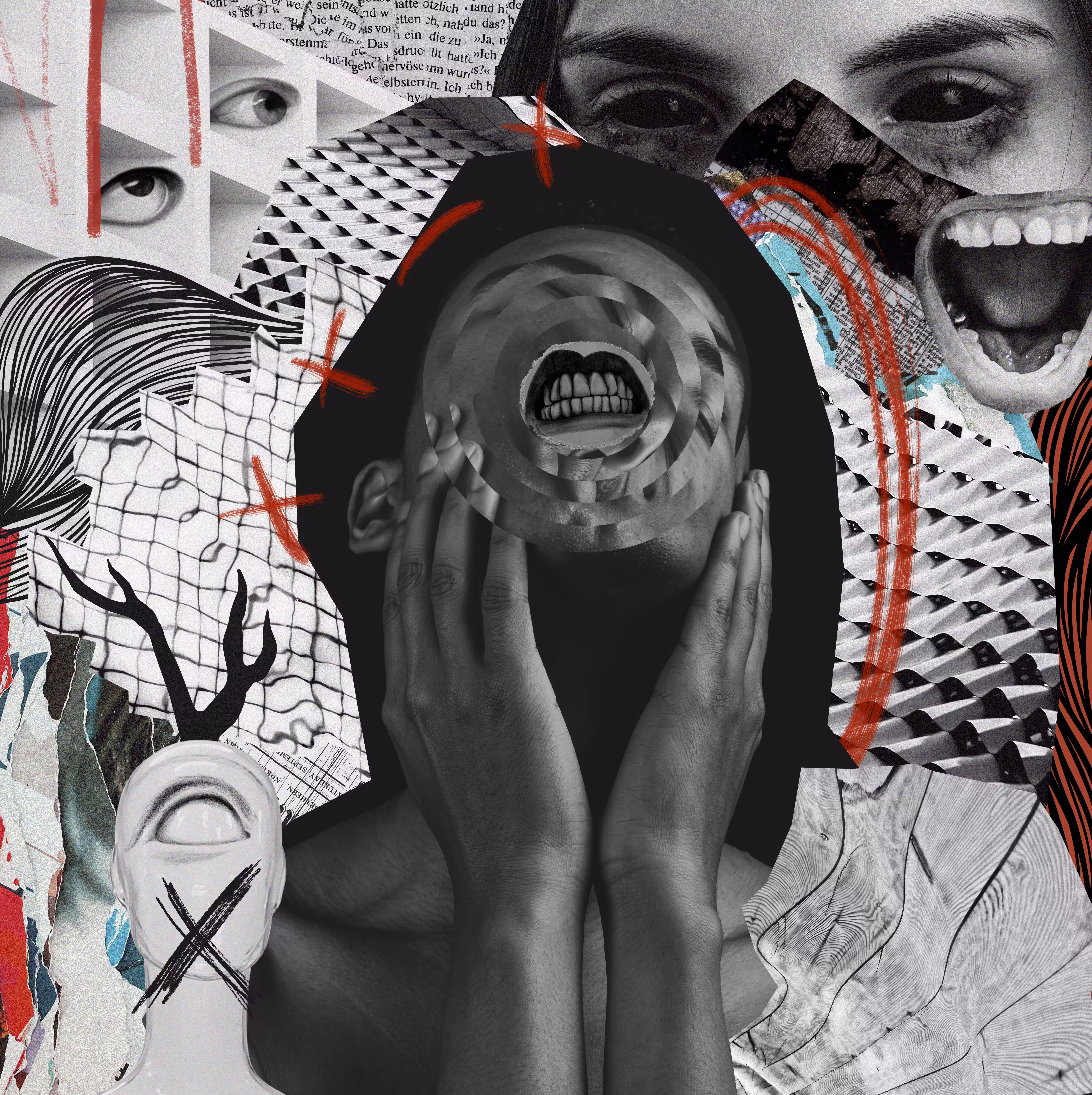 Migraine