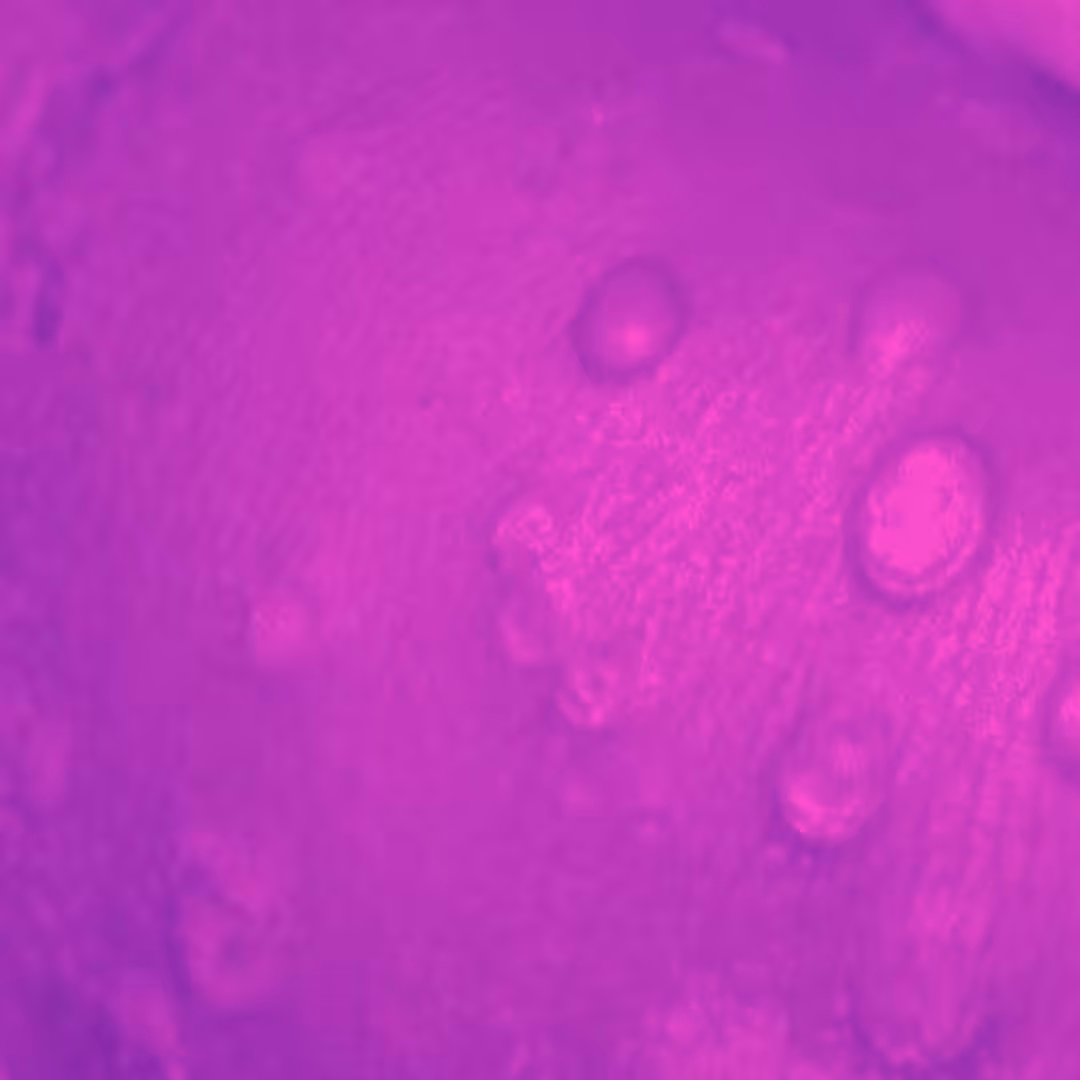 Monkeypox (jour 01)