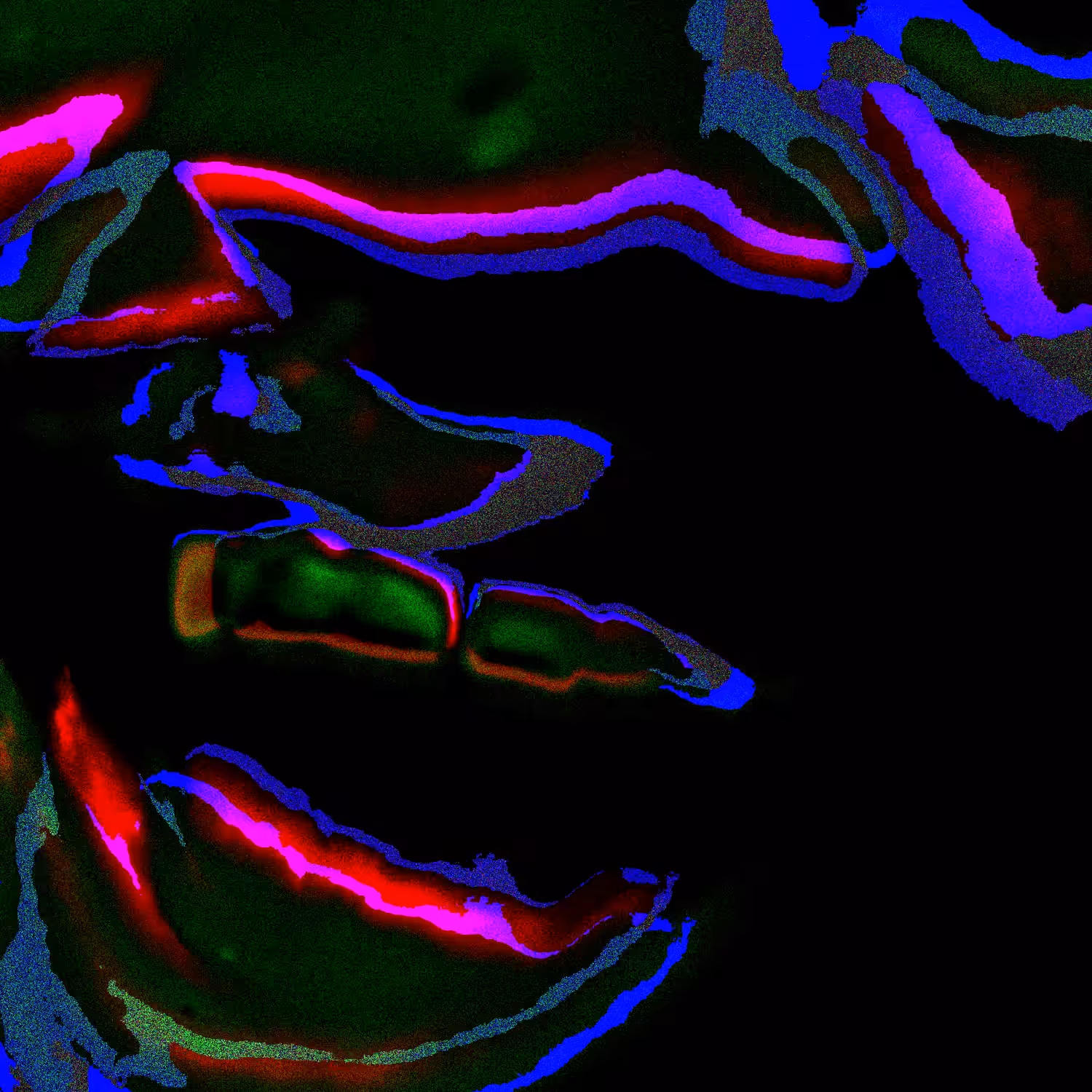 H=3nn = h1n - (~~'no eyes'\\ face at screen) // glitch#2!!
