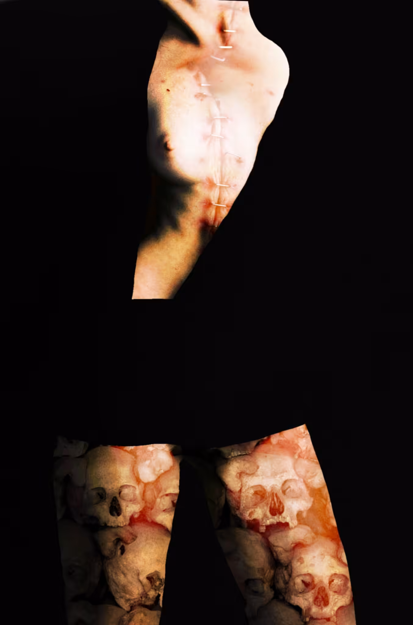 Wounded Body