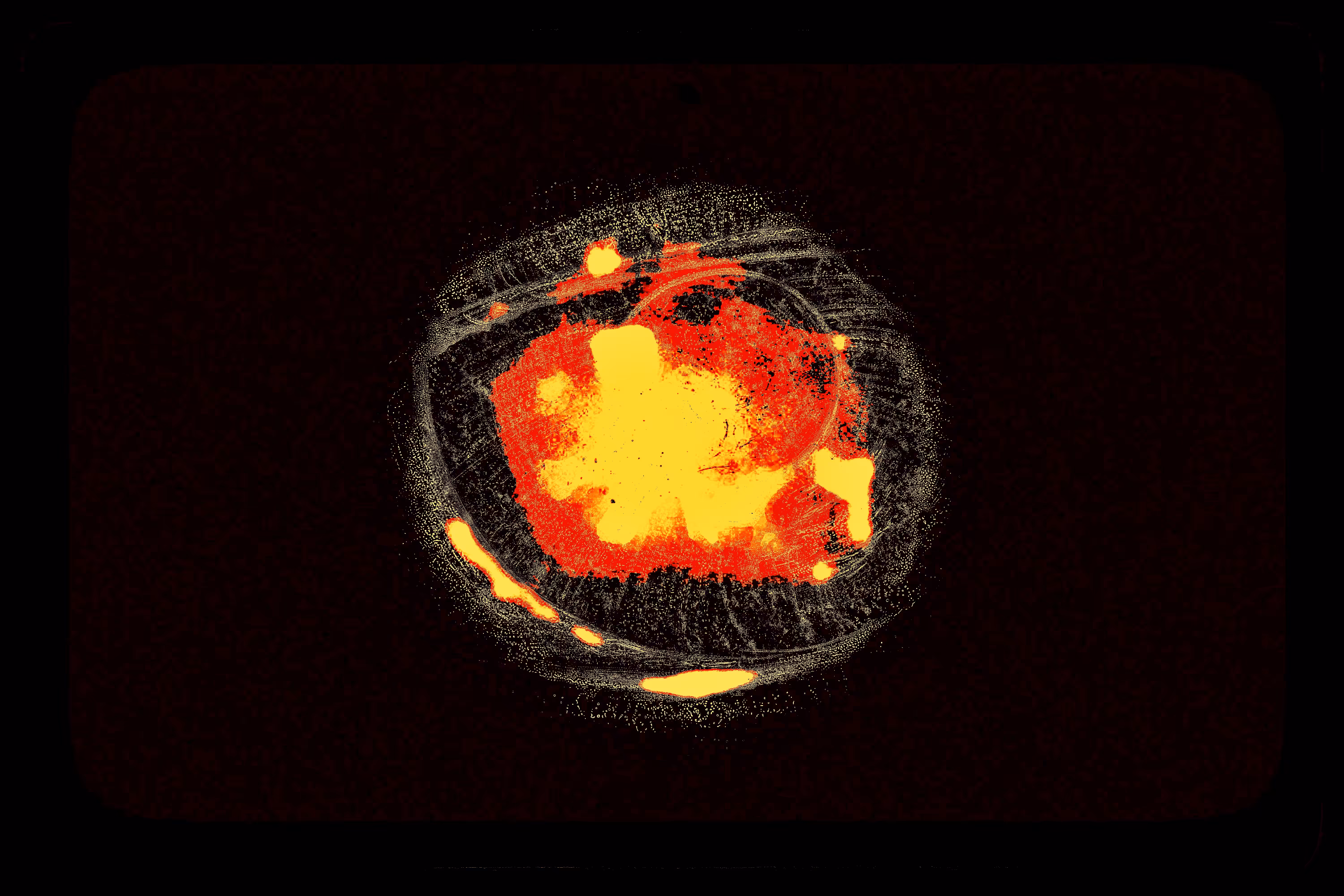 Eye #3