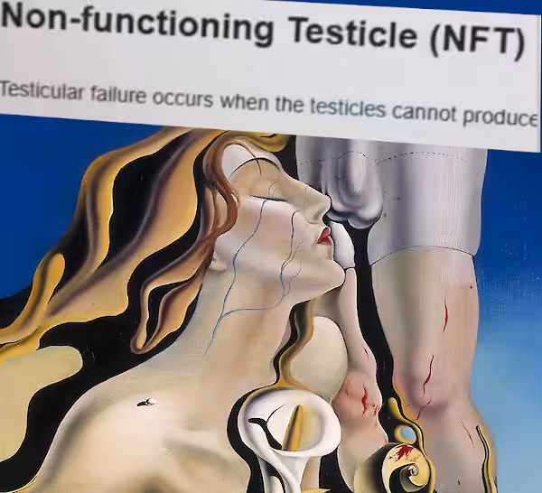 NFT