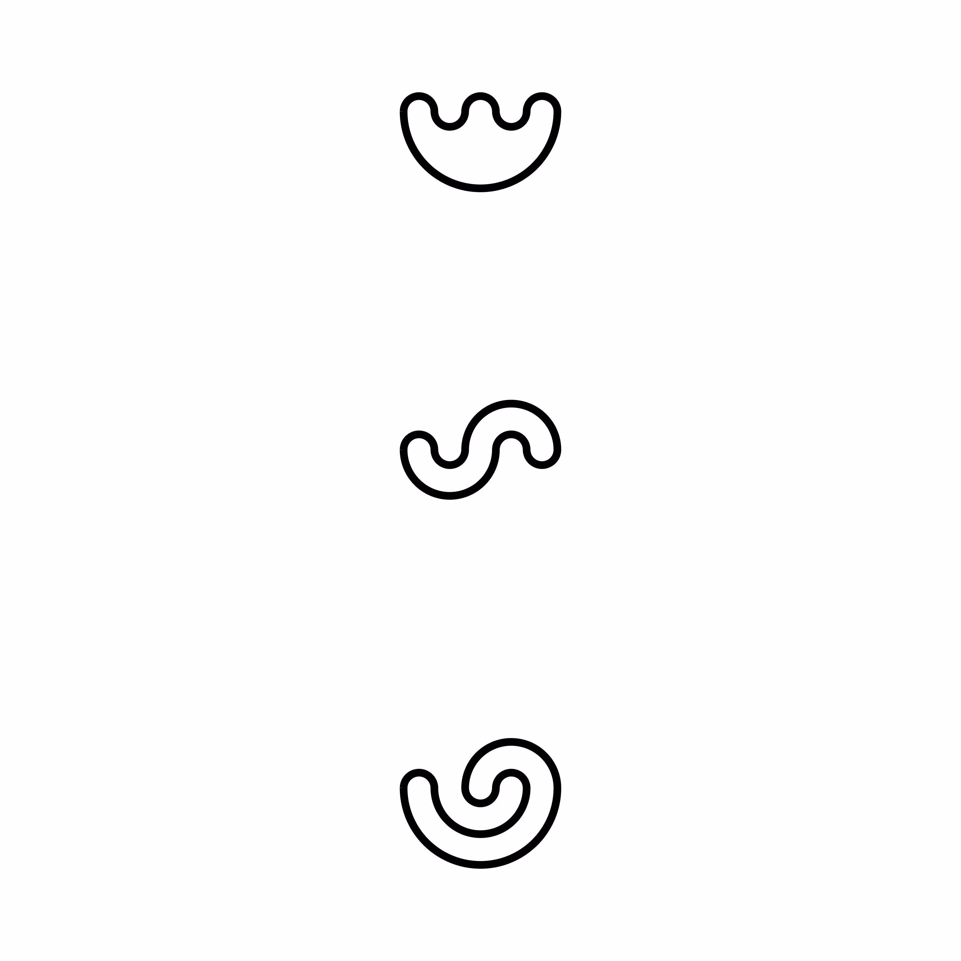 Rubber band folds (N=3) 3 cases