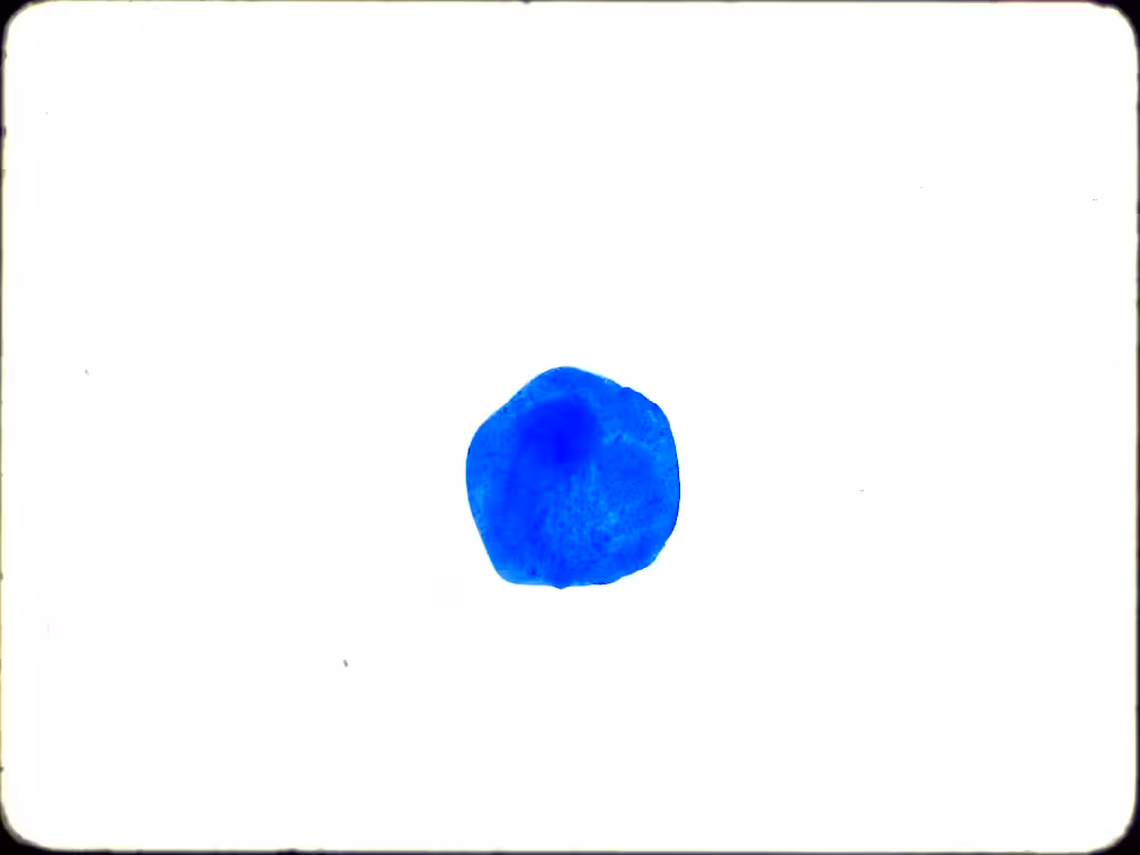 Blue Dot Test