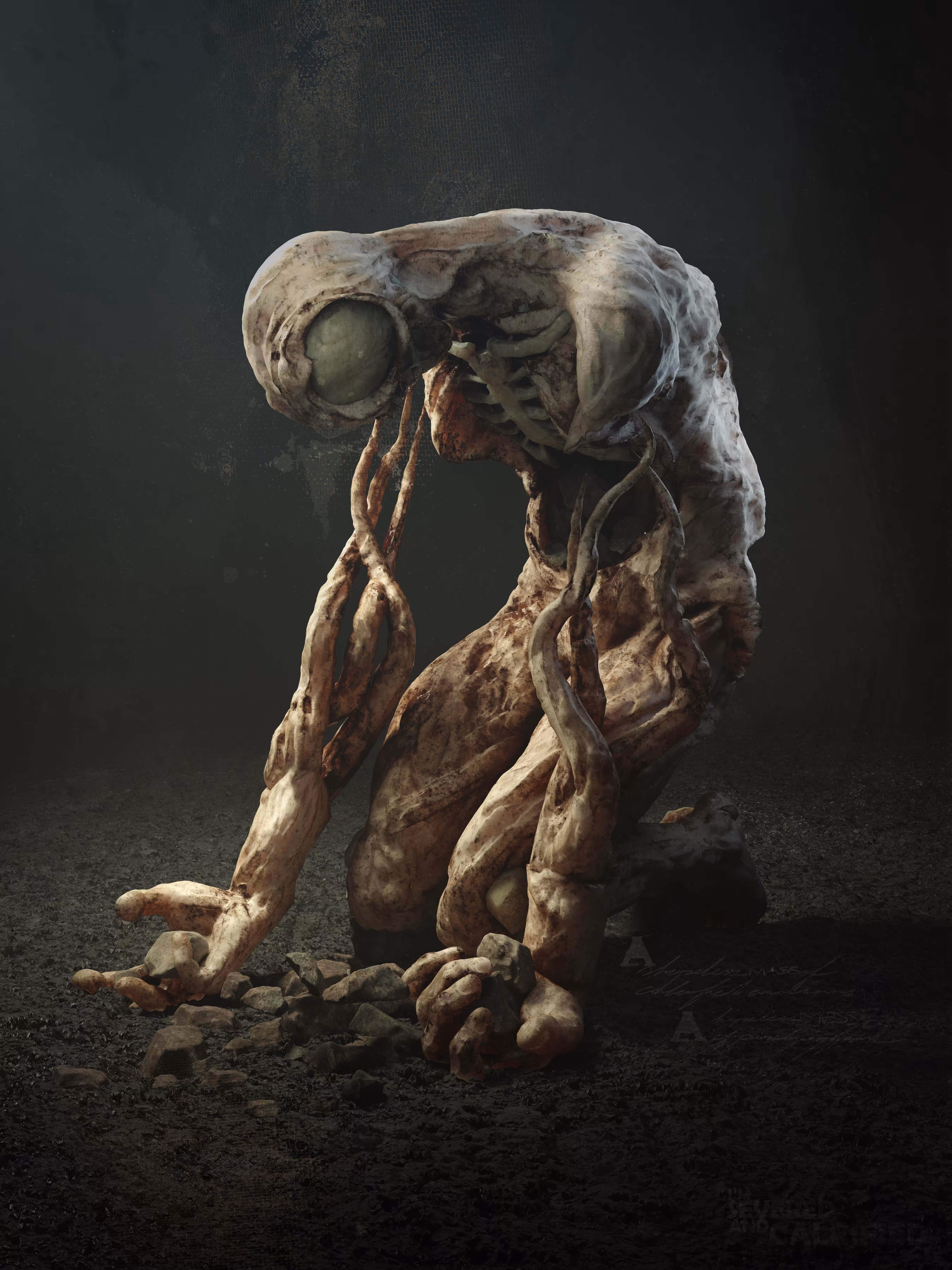 Severed and Calcified