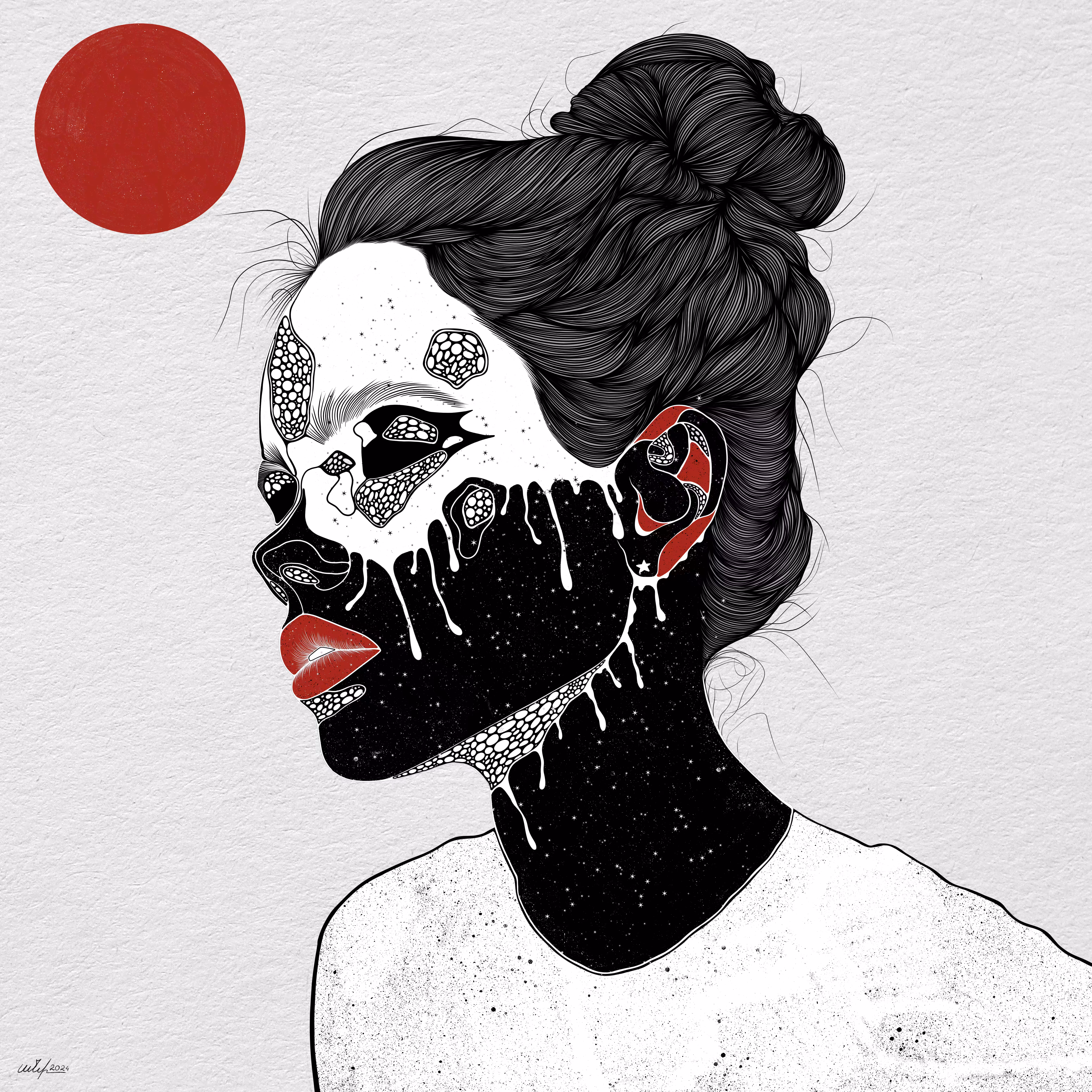 LUPUS