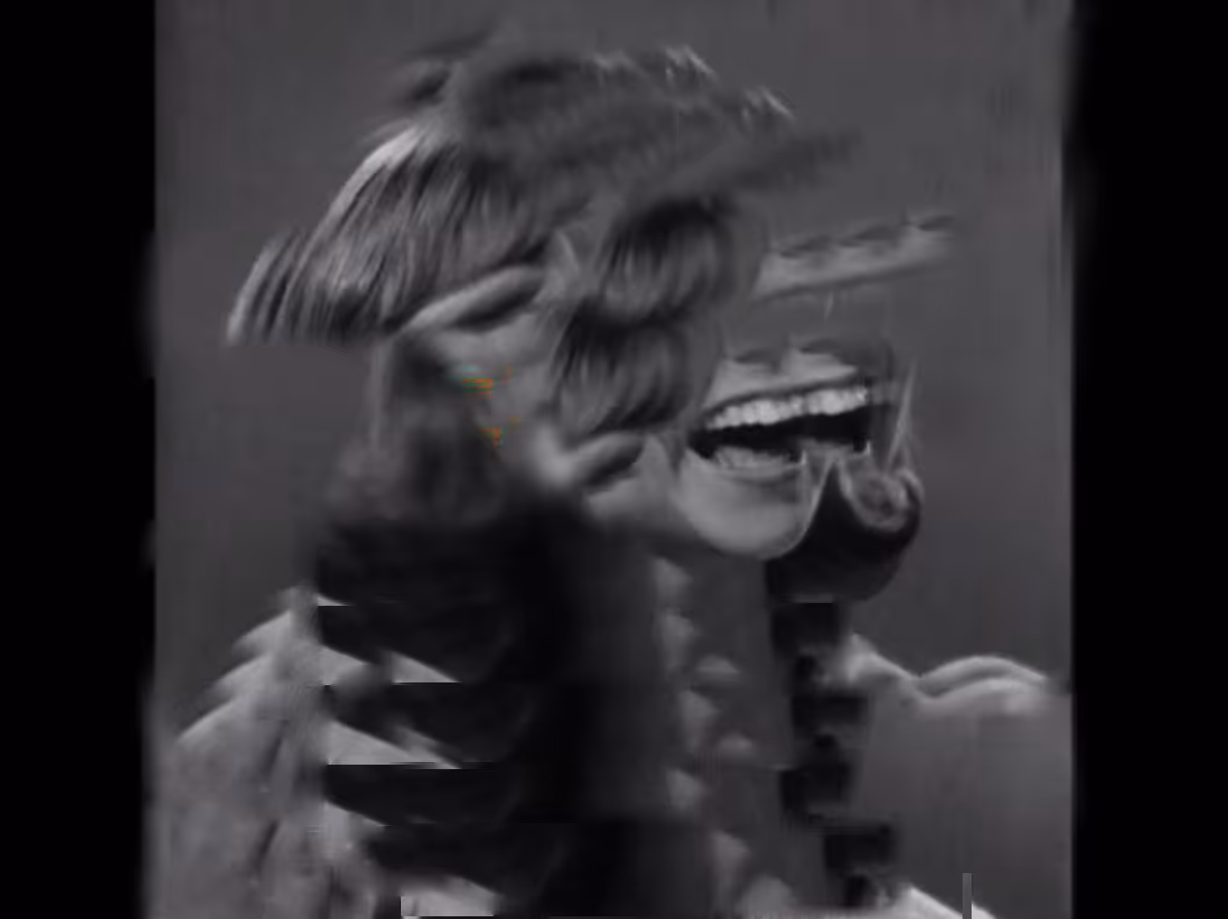 Degenerative Smile