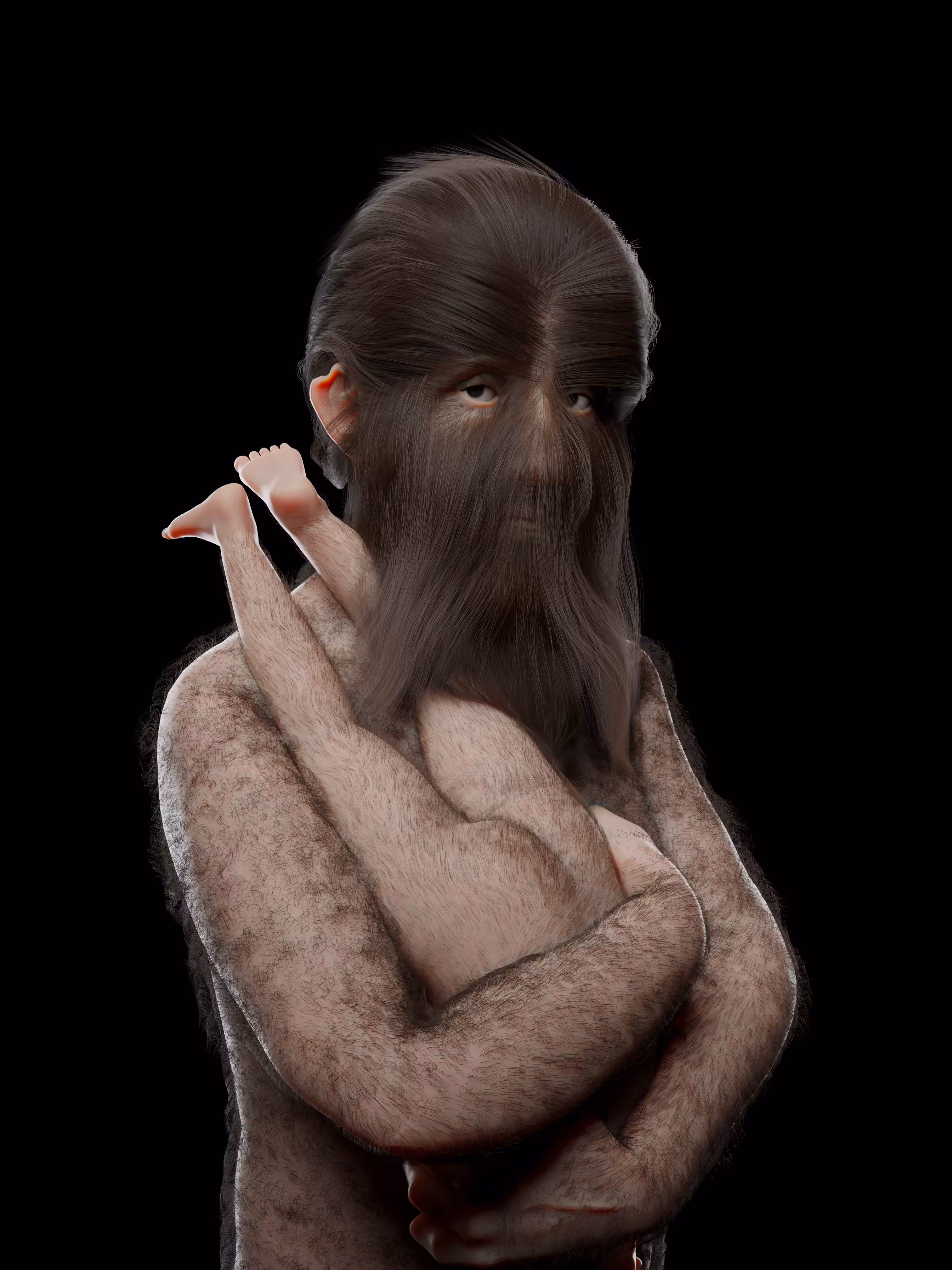 Portrait Hypertrichosis 