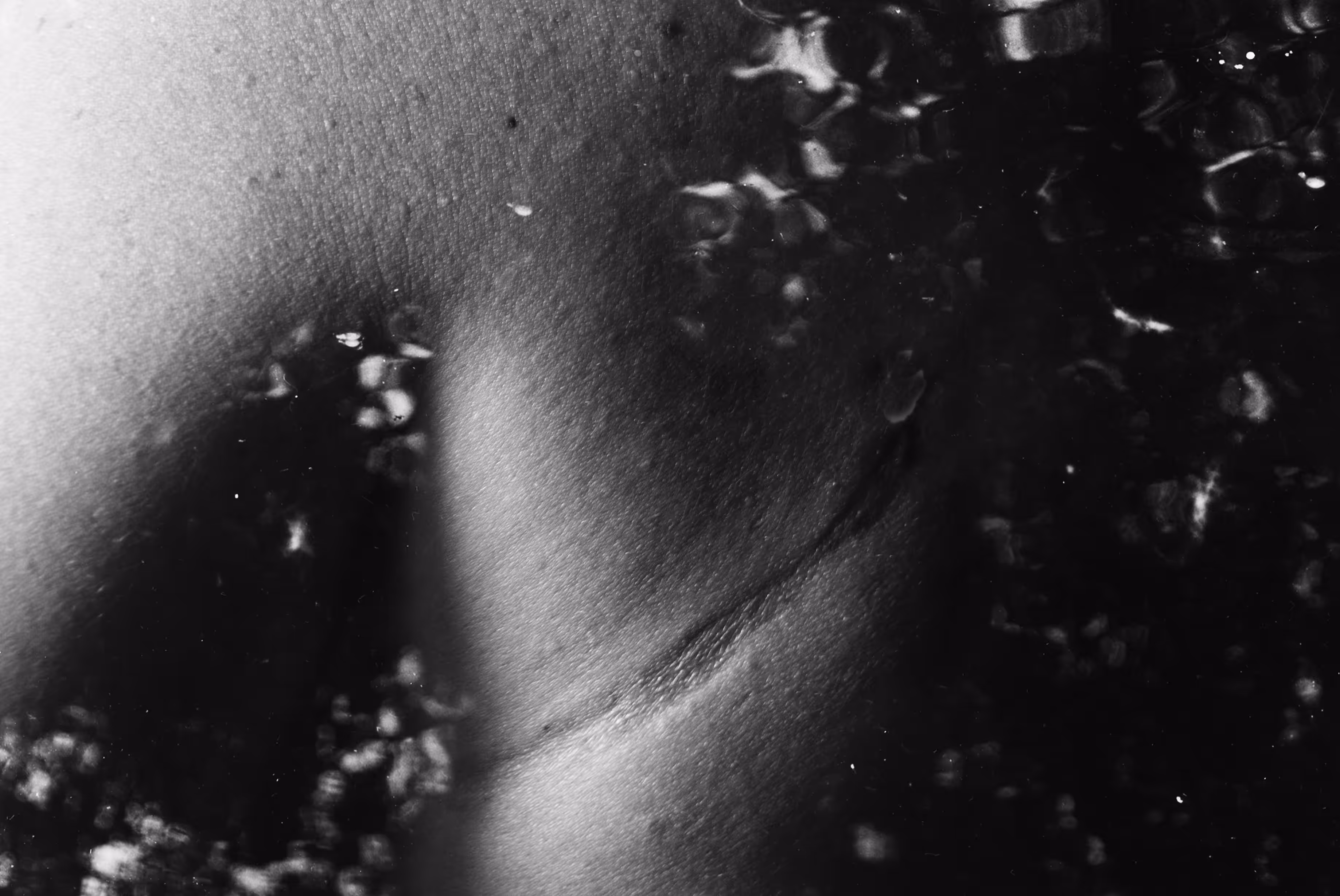 Scar Tissue