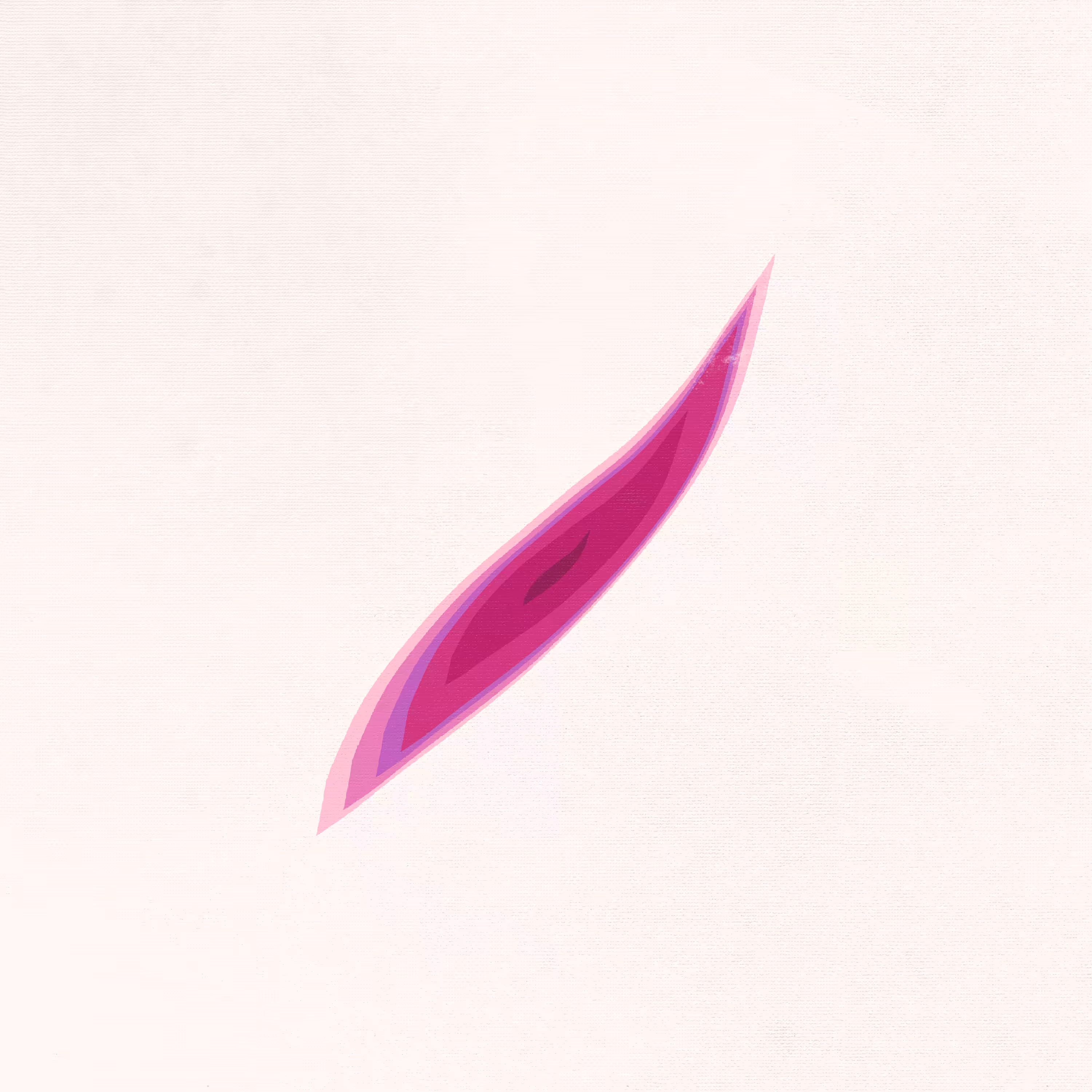 Wound